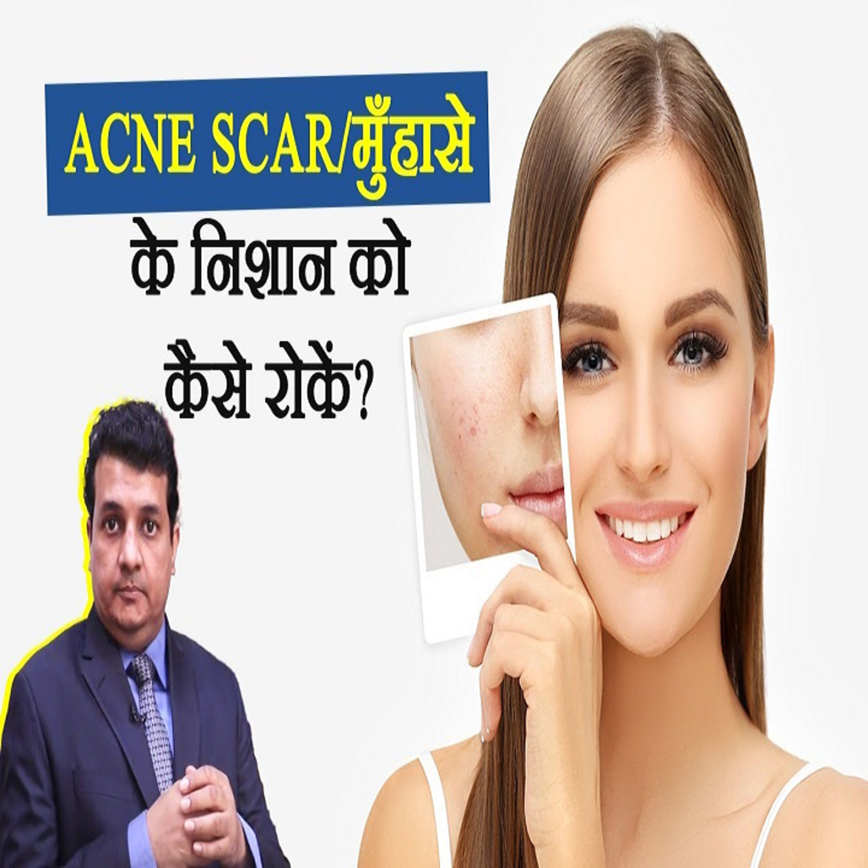 How long does it take to see the result of Hair Transplant.
