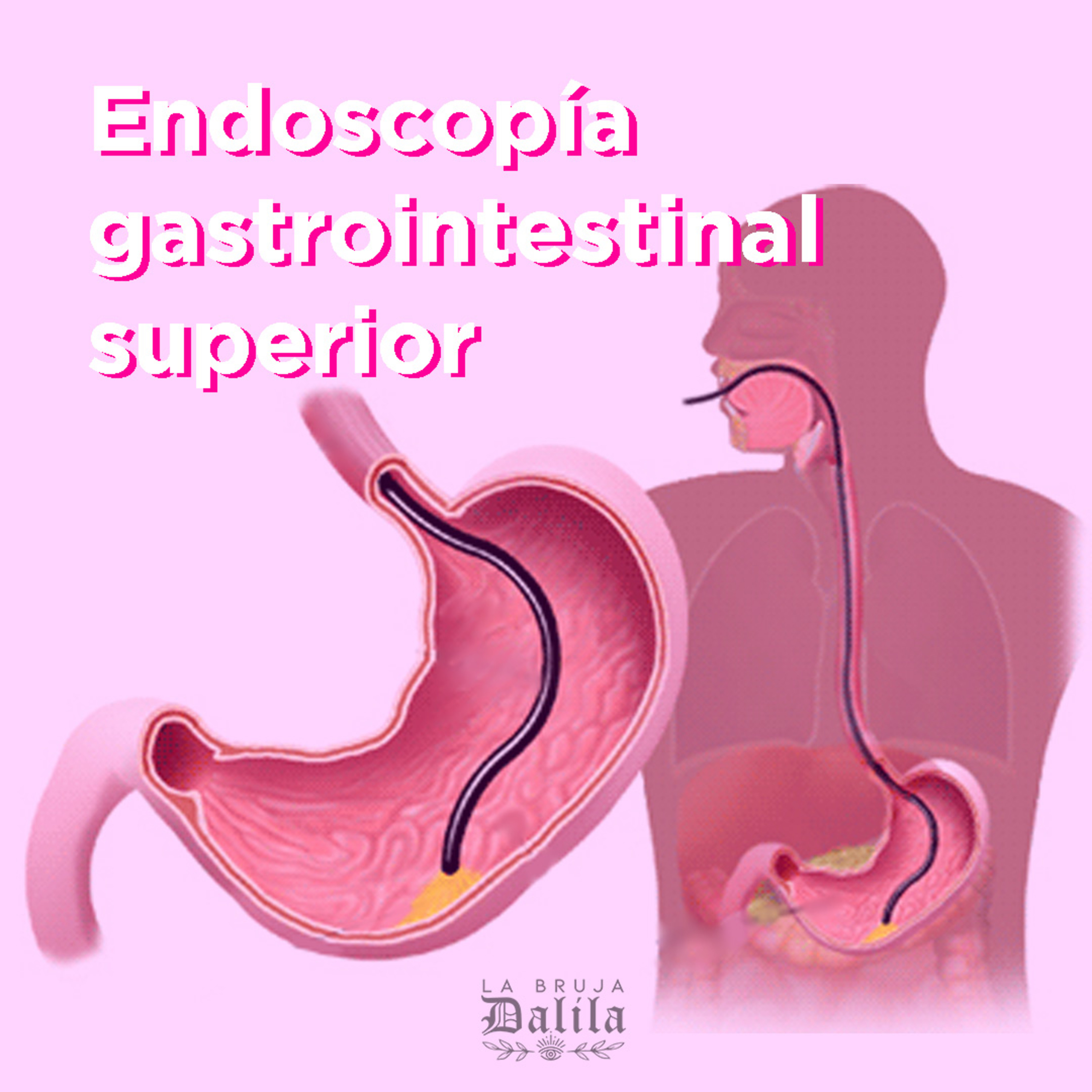 Endoscopía gastrointestinal superior episode artwork