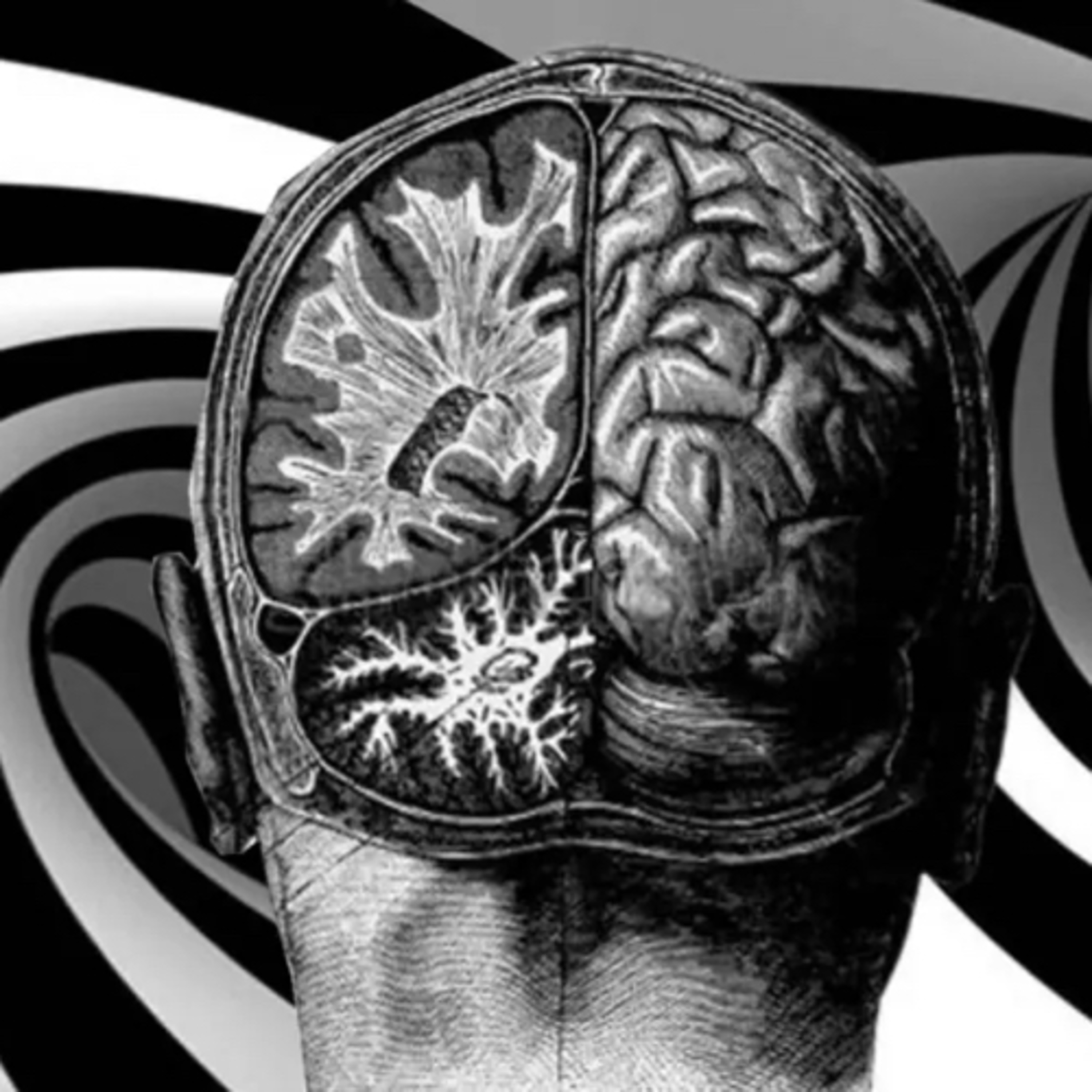 Psicosis: cuando la percepción falla  episode artwork