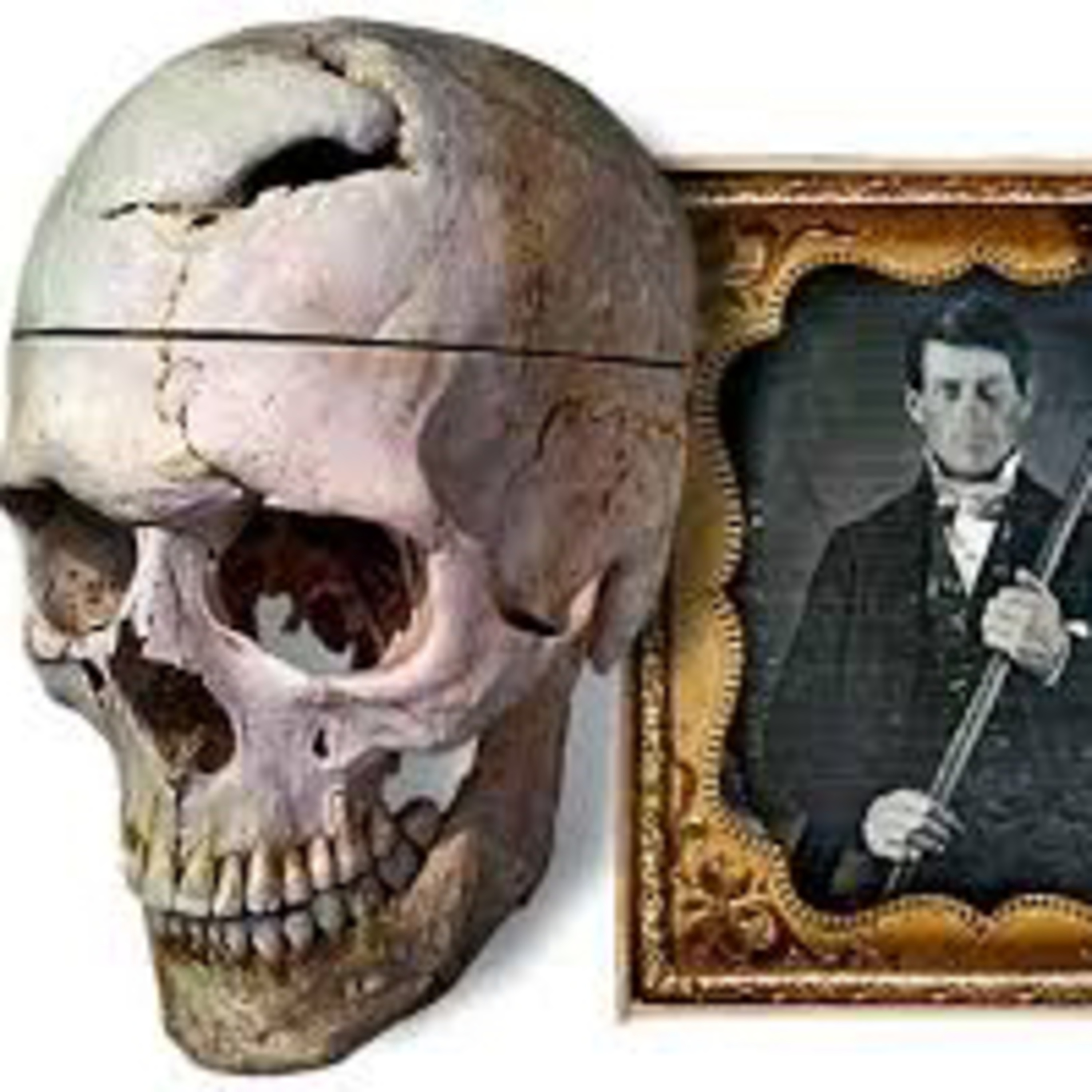 Phineas Gage: lóbulo frontal y personalidad  episode artwork