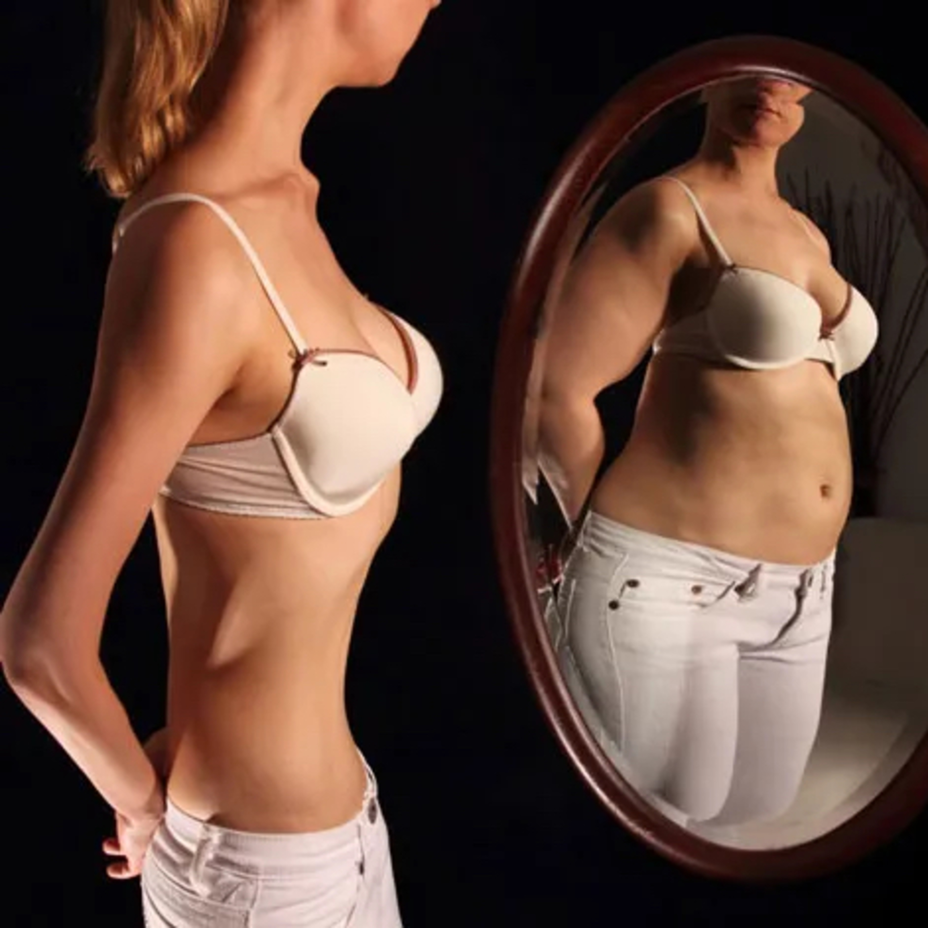 Anorexia y bulimia: factores de riesgo y tratamiento