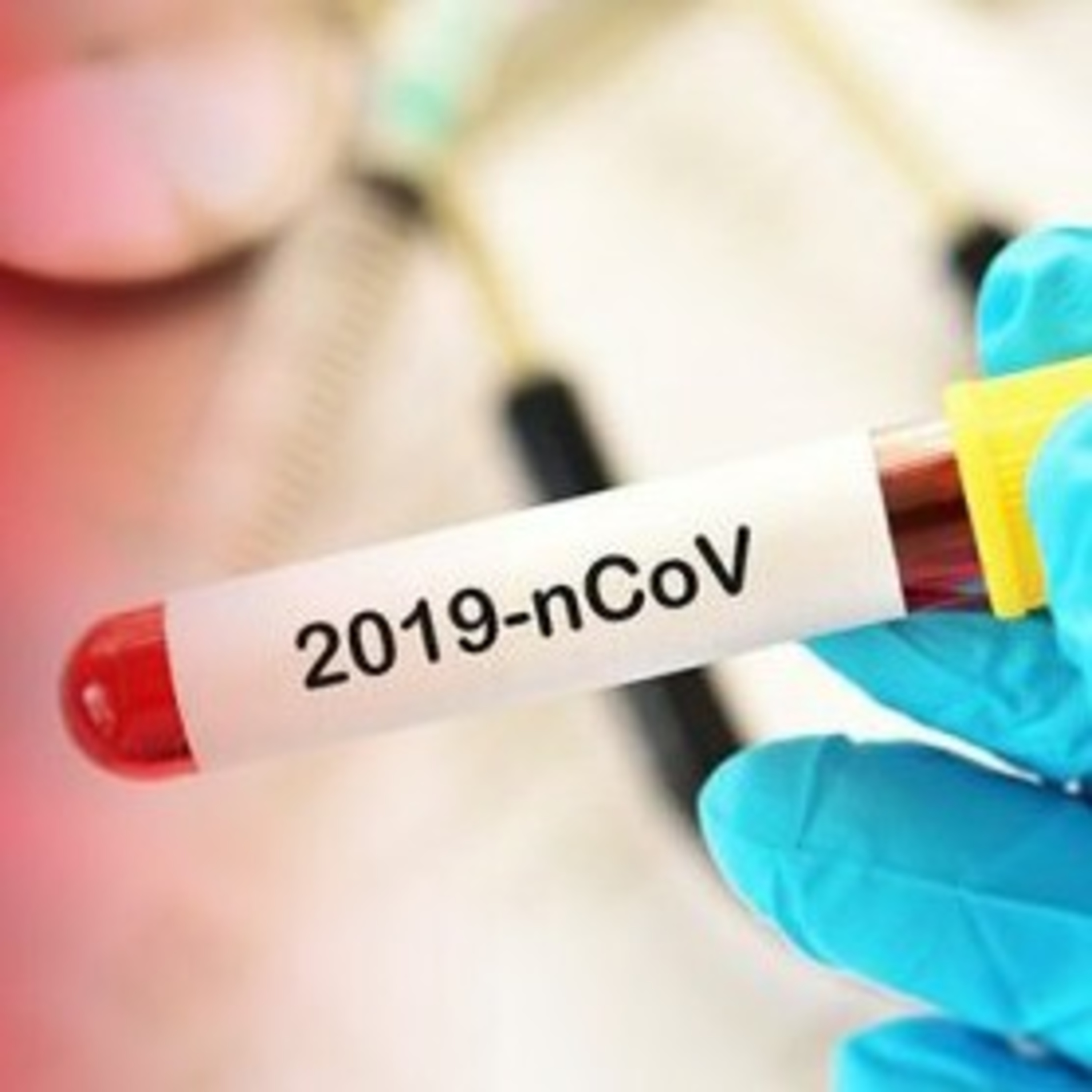 131 nouveaux cas confirmés de Coronavirus au Maroc, portant le total des contaminations à 3889