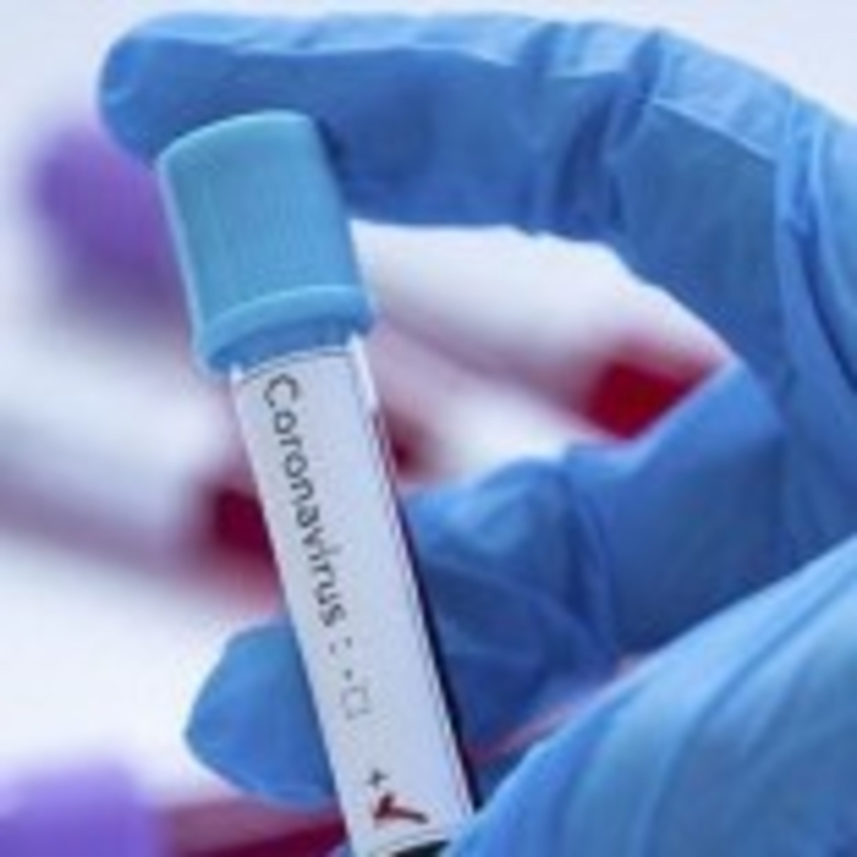 139 nouveaux cas d'infection au coronavirus ont été confirmés au Maroc portant le total à 3897 