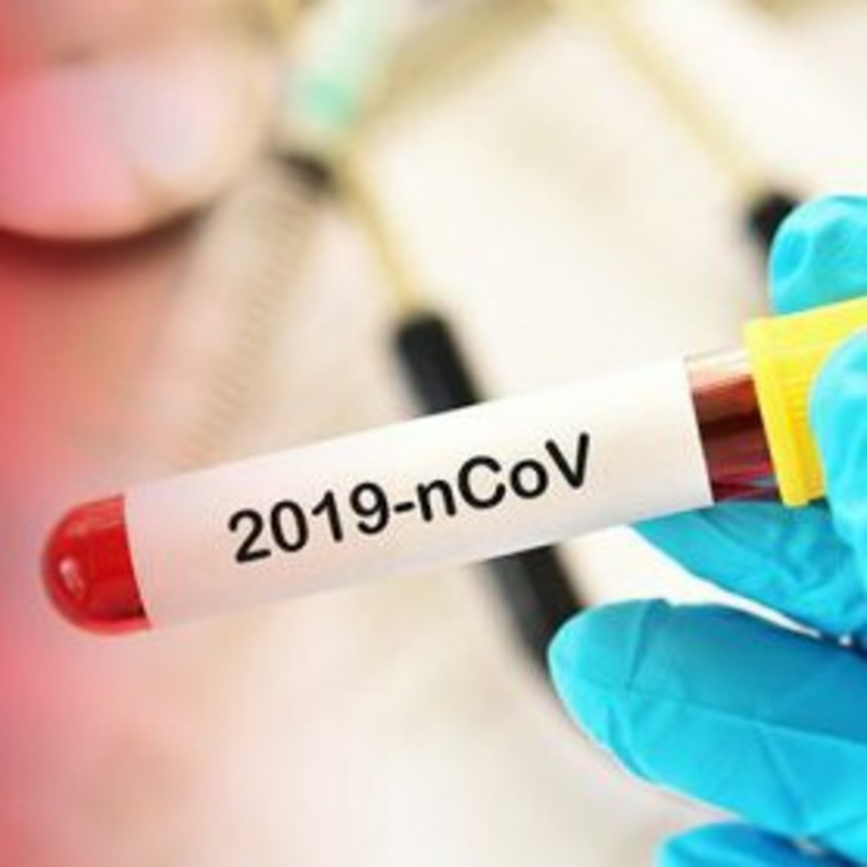 Covid-19/Maroc : 135 nouveaux cas d'infection, dont 71 rien que dans un foyer à Casablanca-Settat

