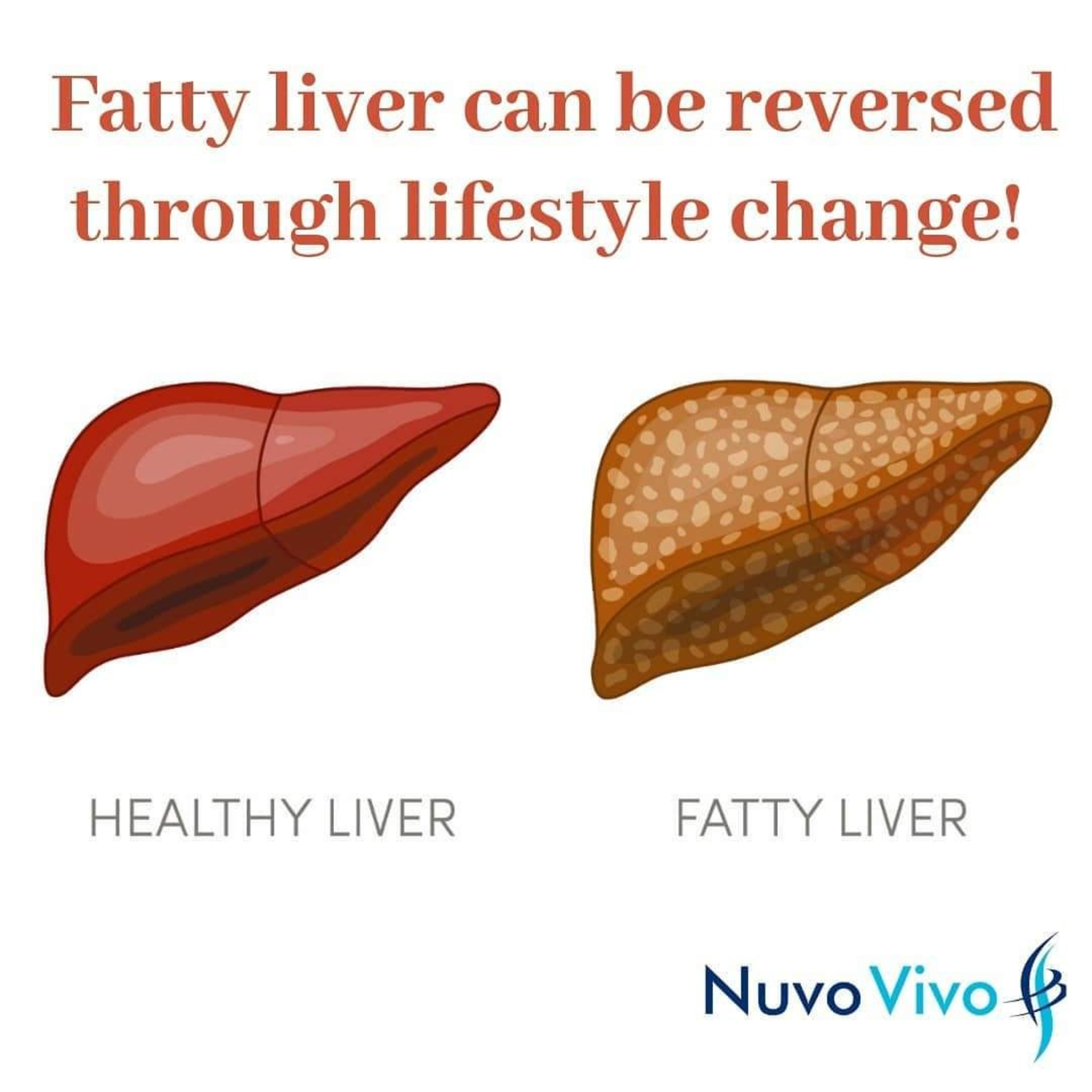 NuvoVivo - Reverse Your Age