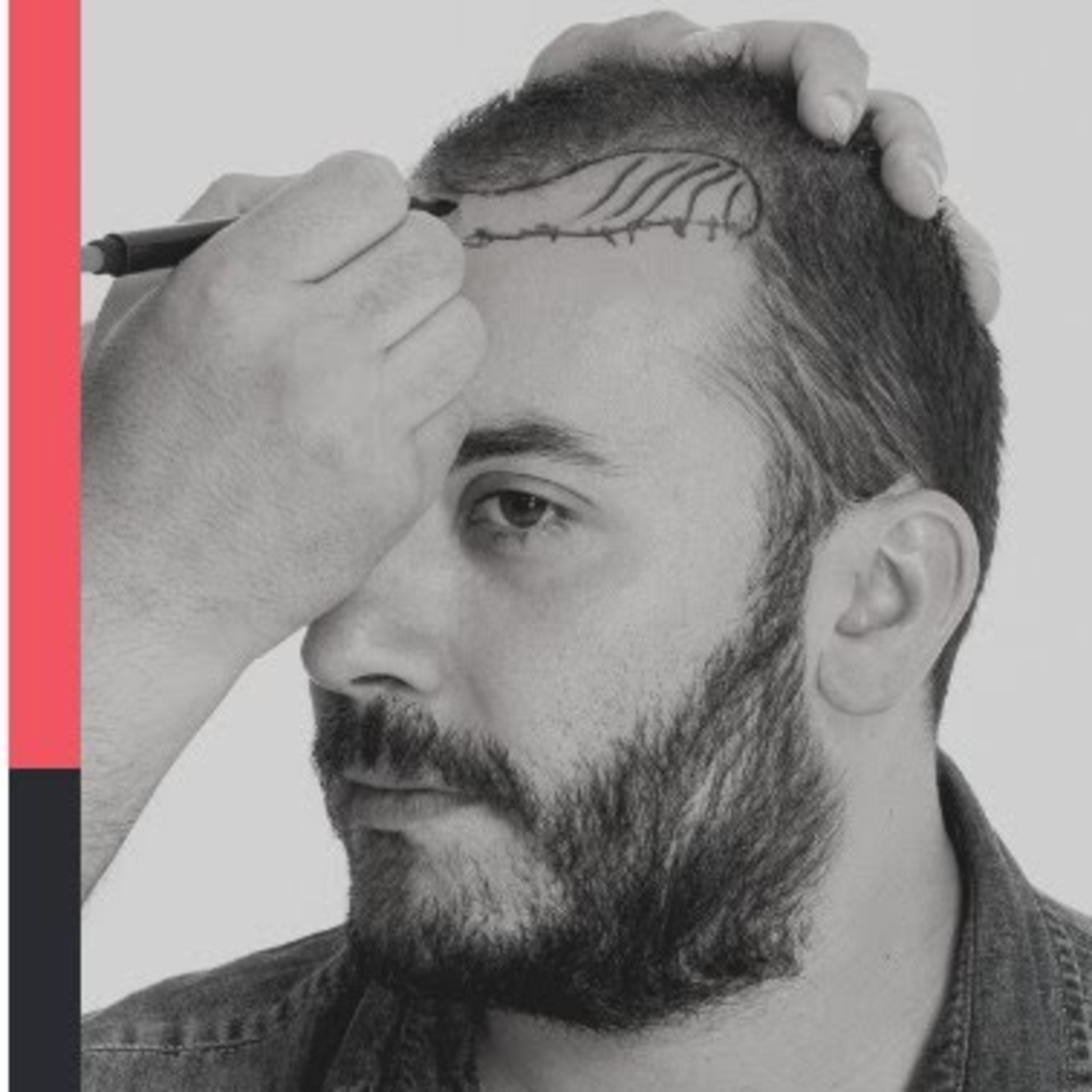 Hair Transplant Podcast - HAIR TALK with Dr.John Watts Hair Transplant Surgeon and Dermatologist