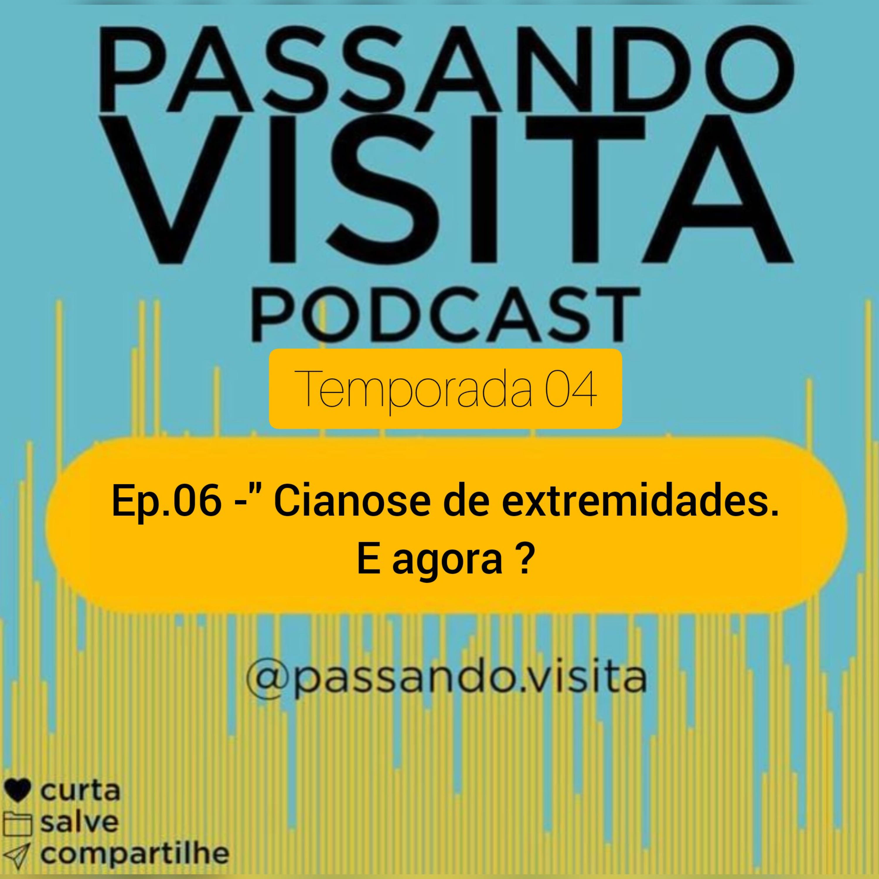 Ep. 06 Tempo. 04 - " Cianose de extremidades. E agora ?
