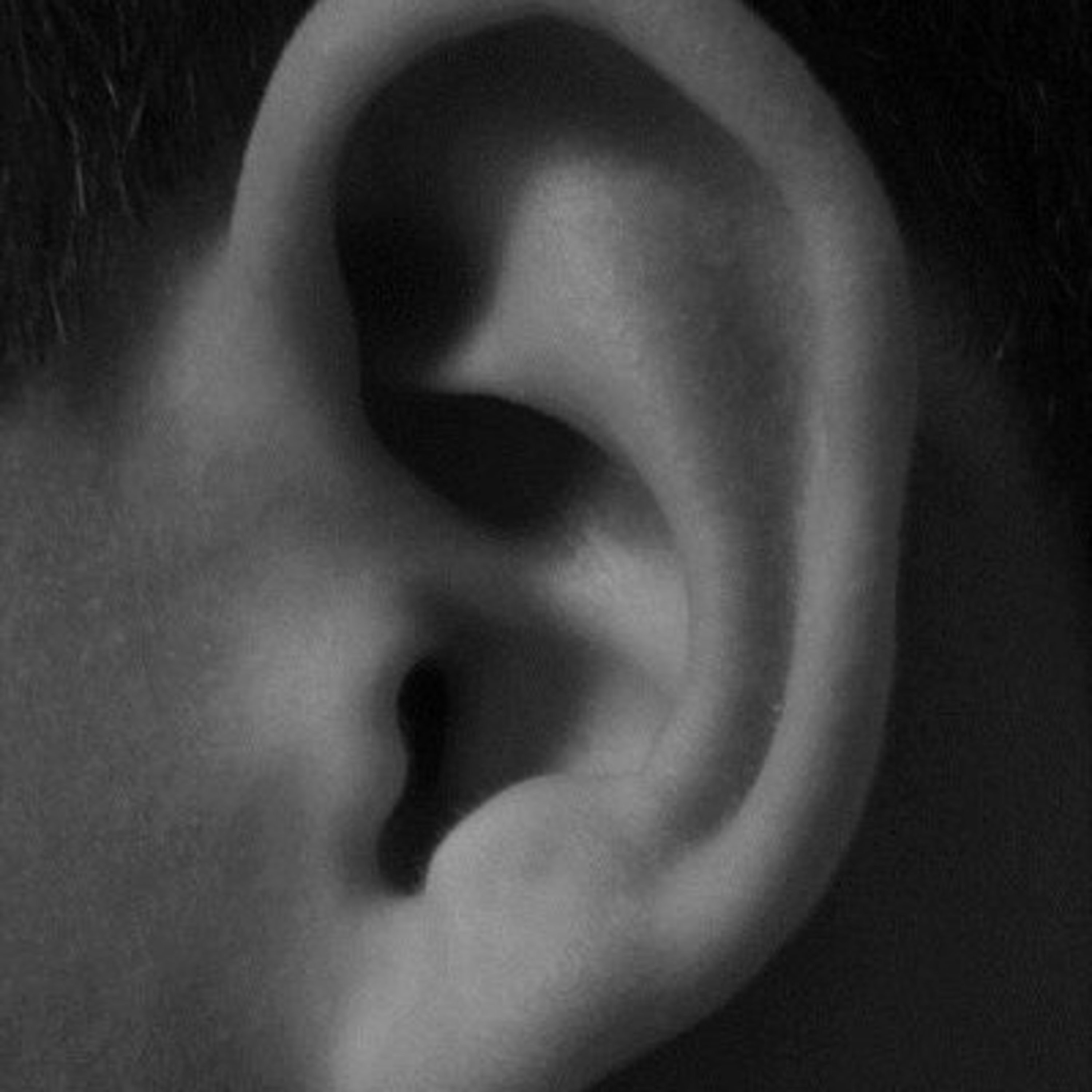 Dazzle\'s Pod