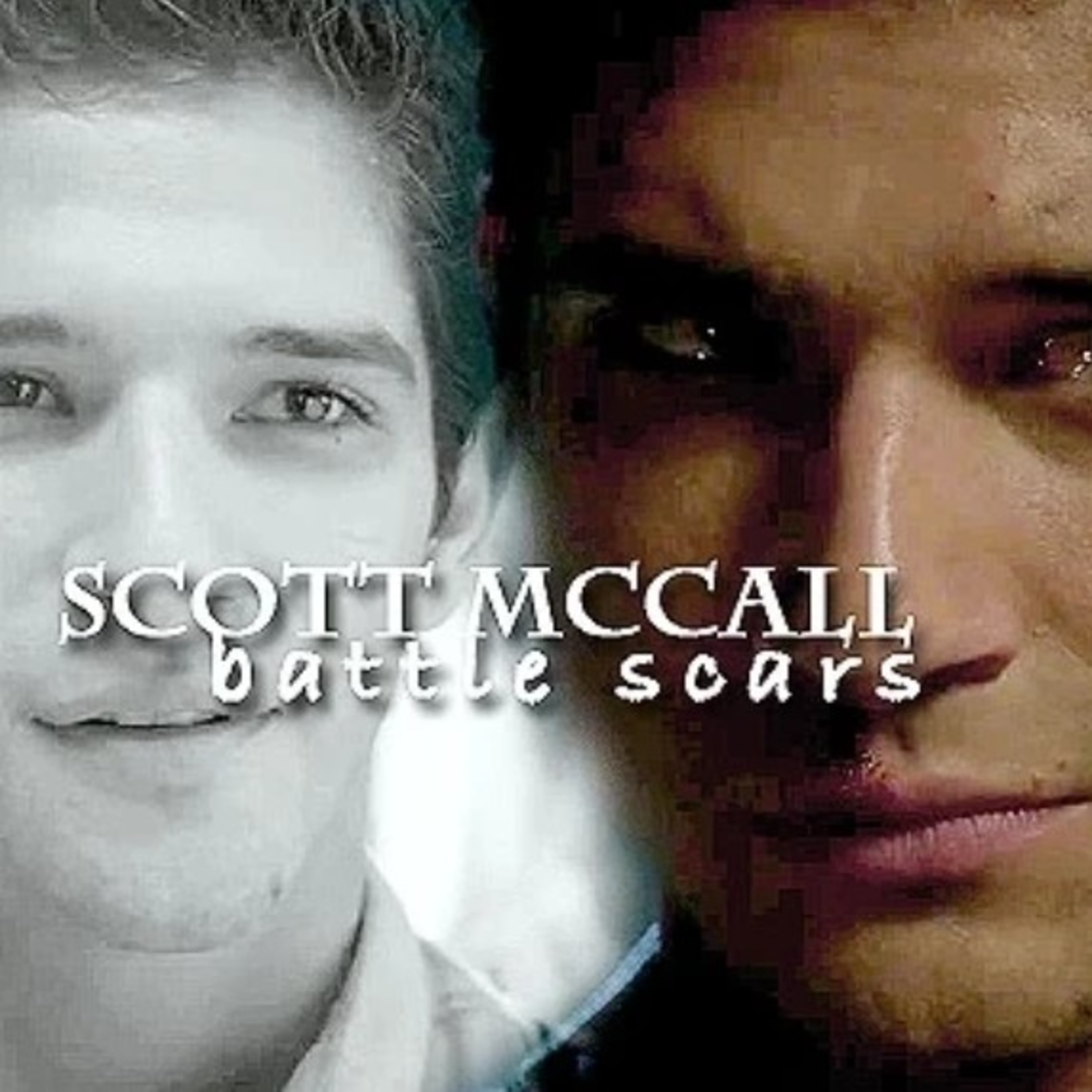Scott McCall | Battle Scars