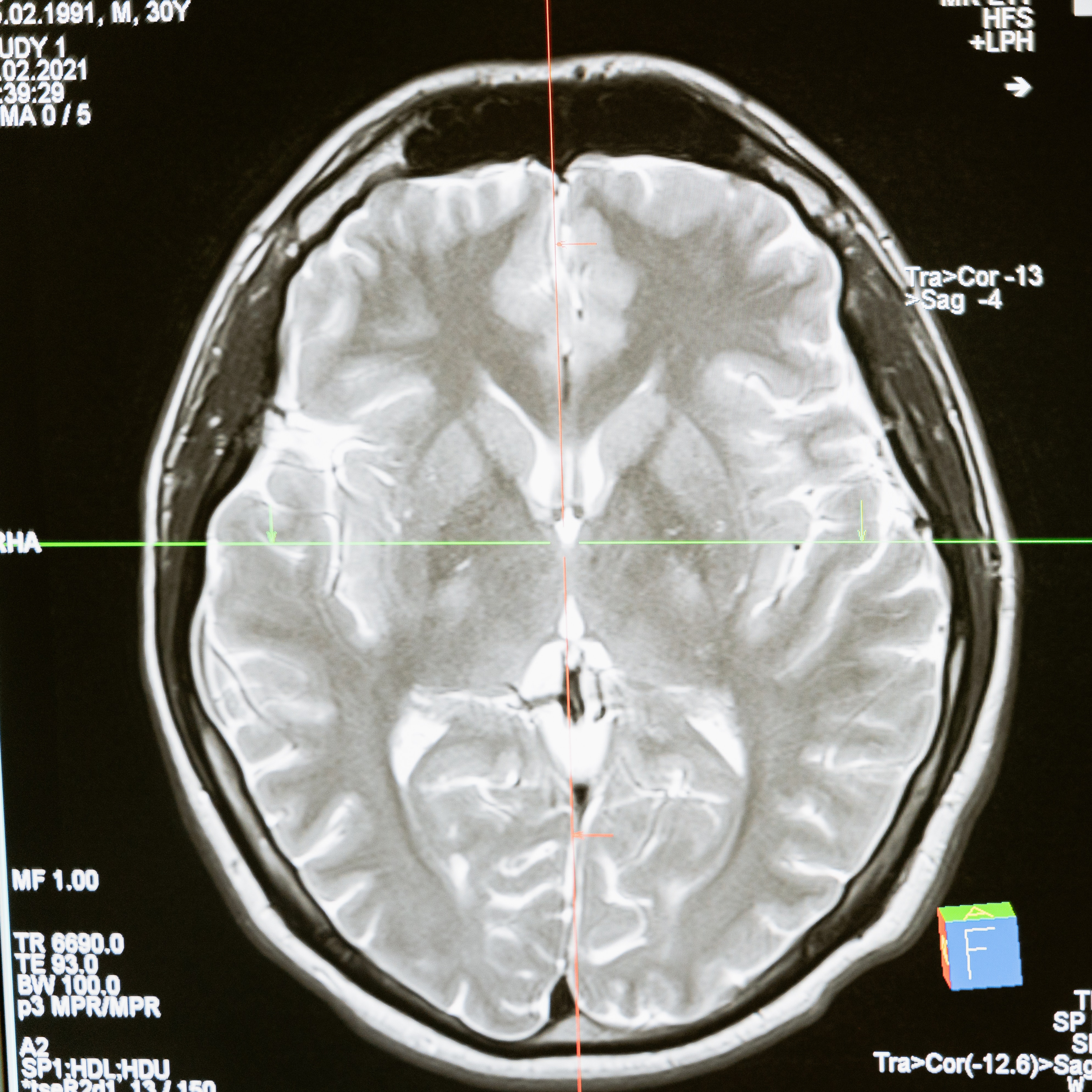 Meningite: Mitos e verdades  episode artwork
