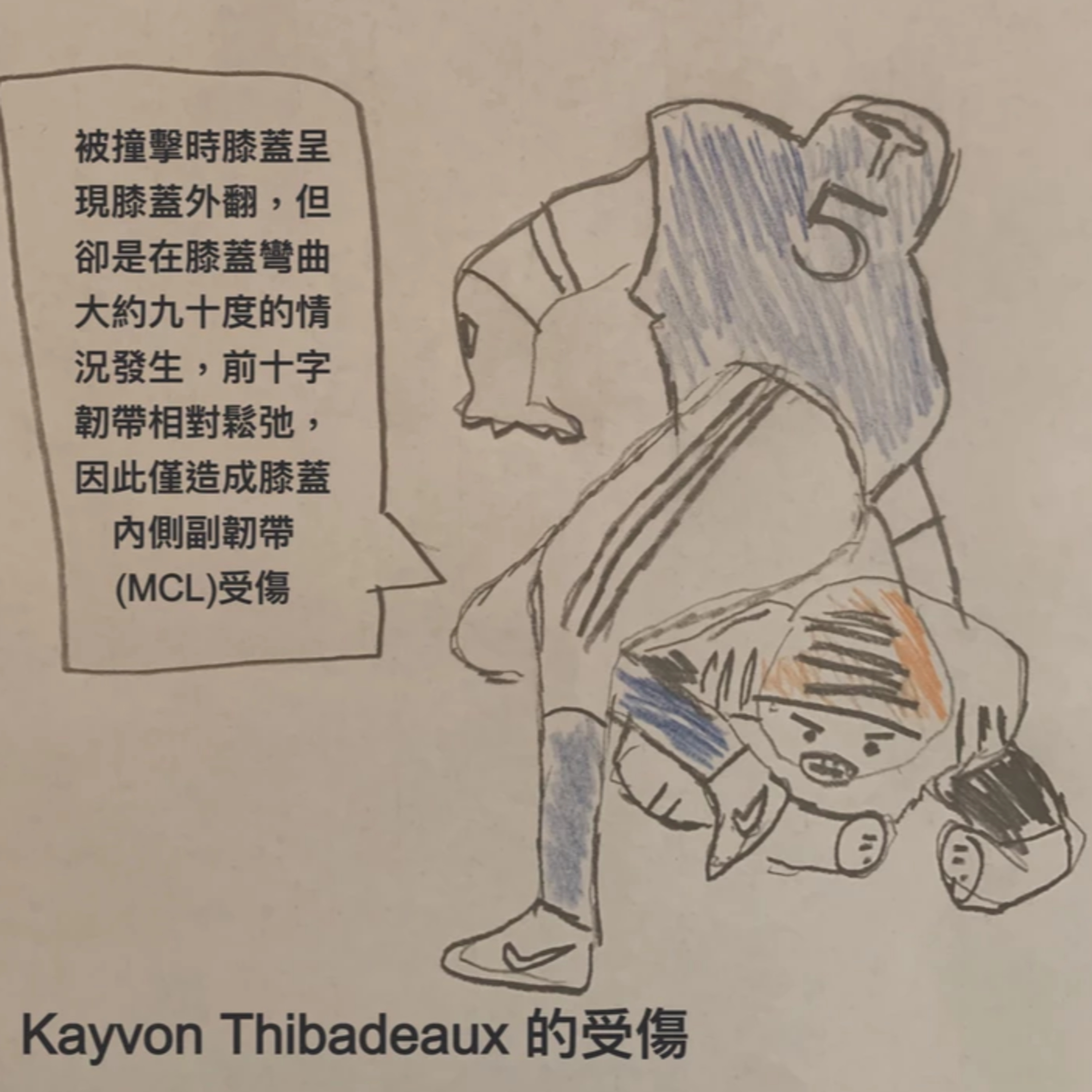 cover of episode ＃102 傷兵Happened： Kayvon Thibadeaux 的膝蓋受傷