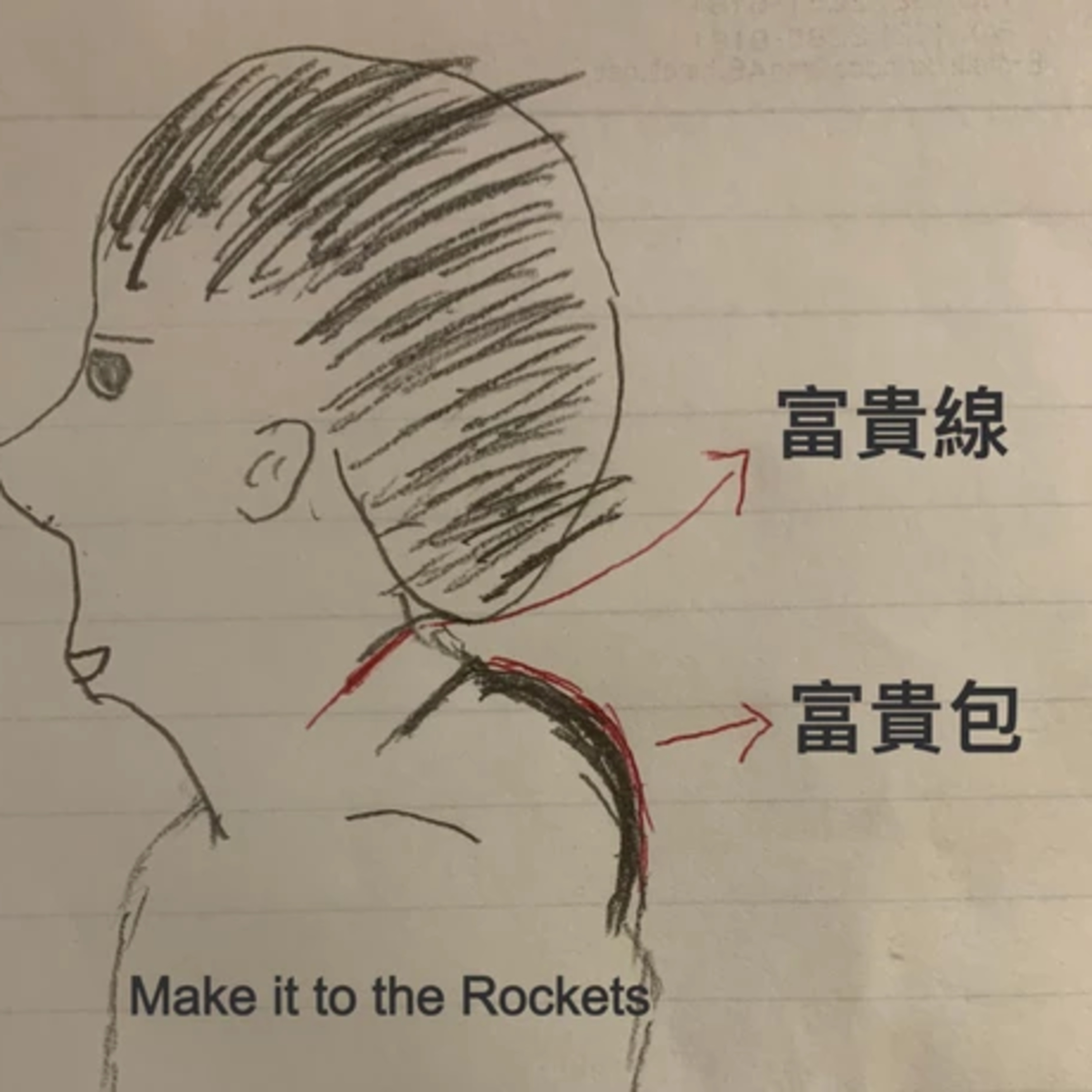 cover of episode ＃103.2 閒聊：小孩駝背怎麼辦？改善駝背的幾個方法