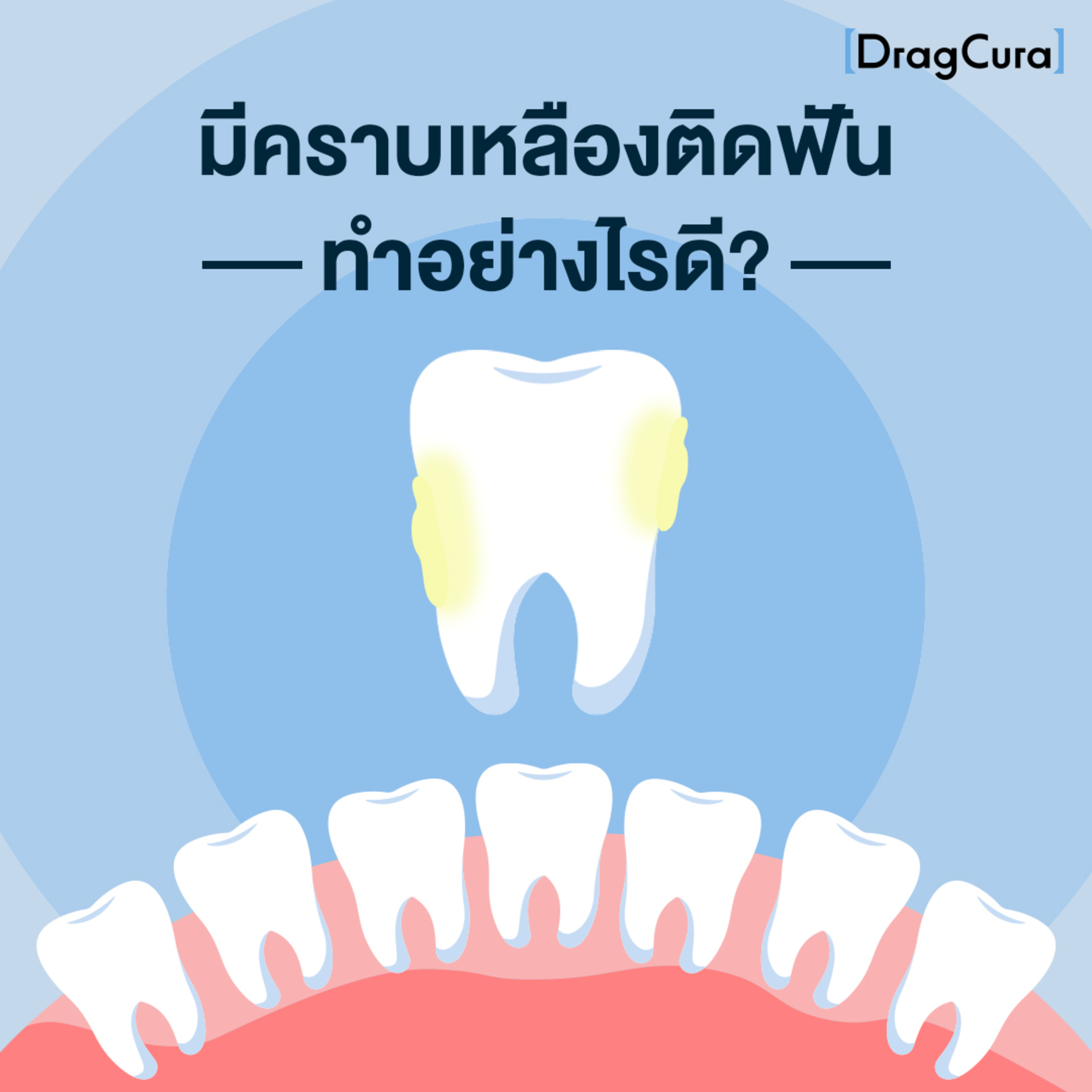 มีคราบเหลืองติดฟัน ทำอย่างไรดี [EP.16] - DragCura Podcast episode artwork