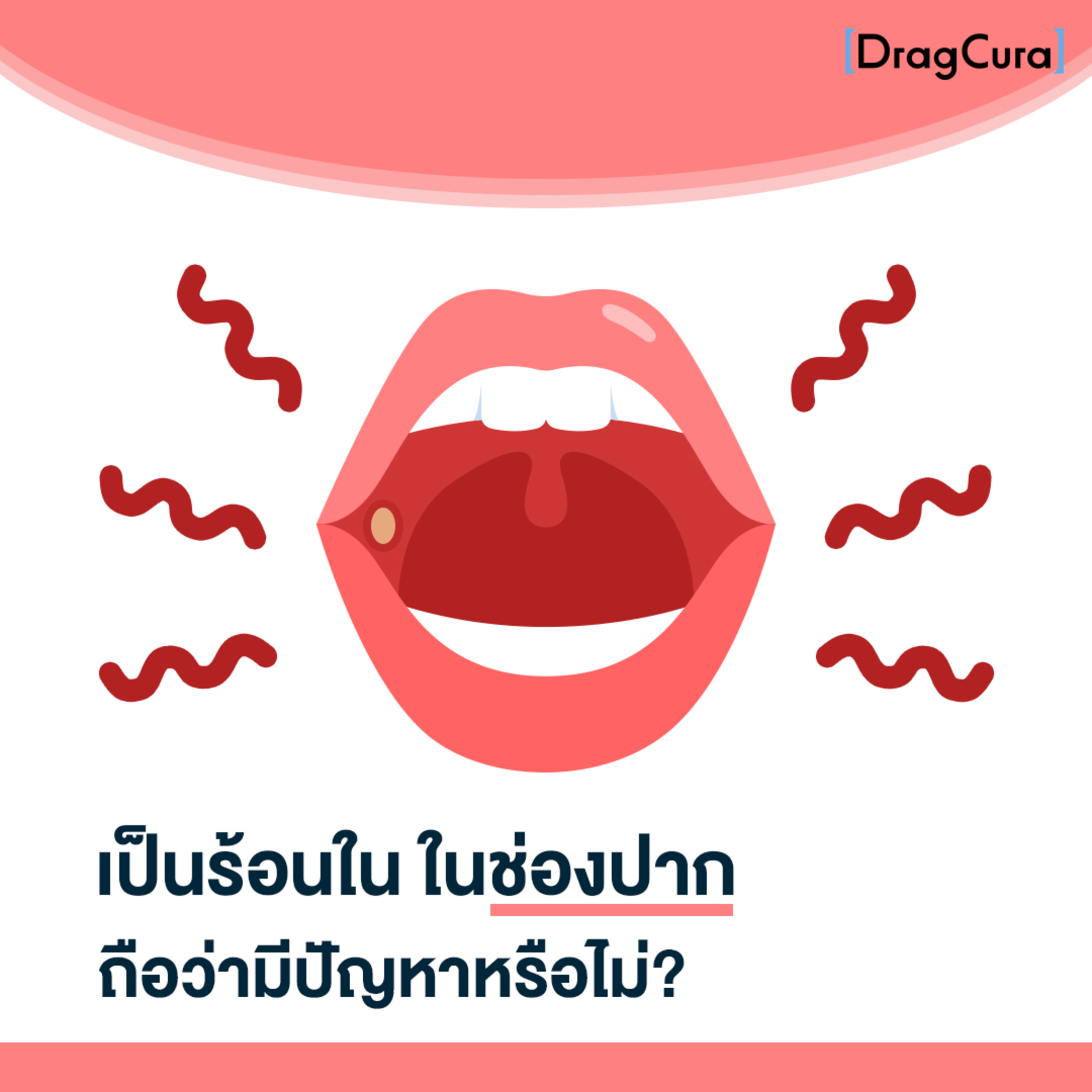 ตอนนี้เป็นร้อนใน ถือว่าเป็นปัญหาไหม [EP.17] - DragCura Podcast