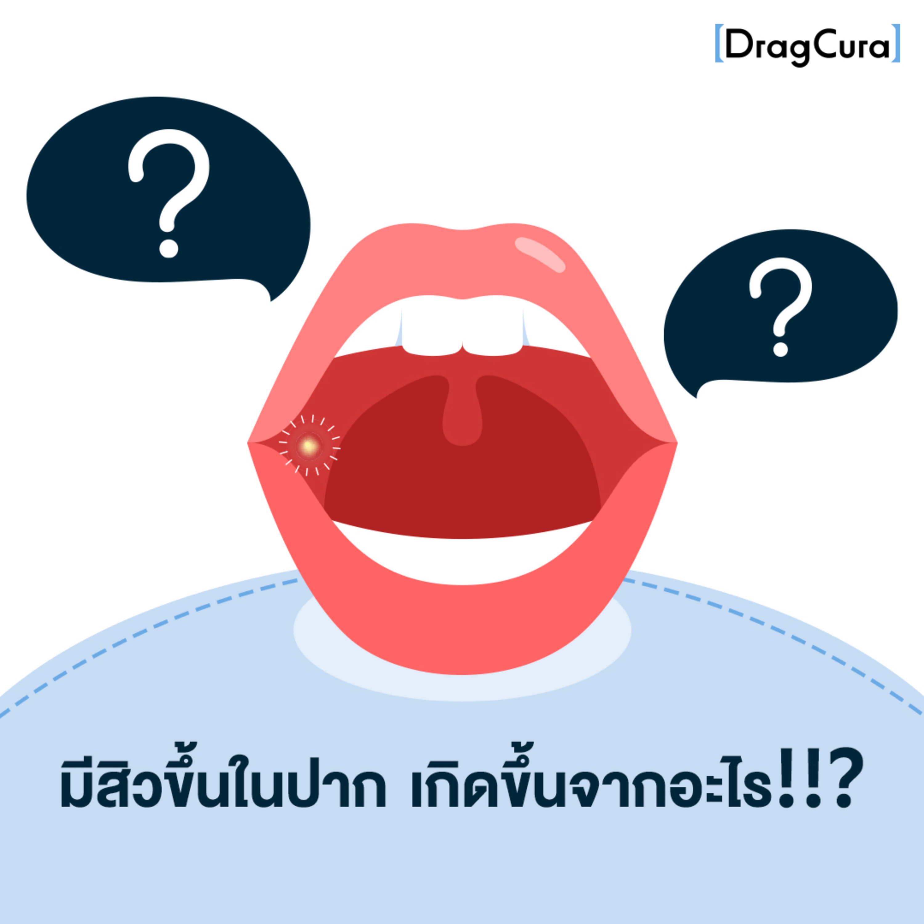 มีสิวขึ้นในปาก เกิดขึ้นจากอะไร!! [EP.22] - DragCura Podcast