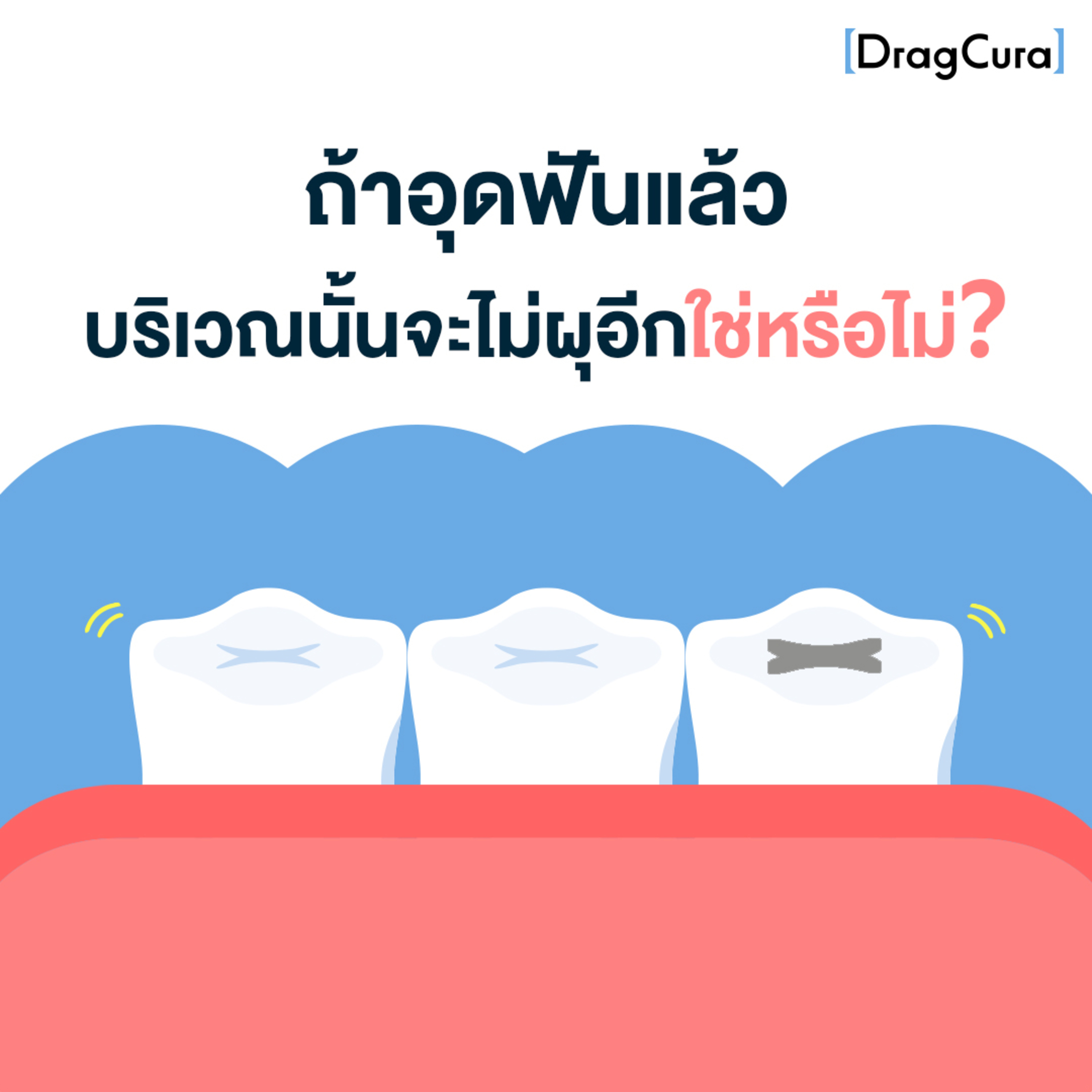 ถ้าอุดฟันแล้ว บริเวณนั้นจะไม่ผุอีกใช่หรือไม่ [EP.38] - DragCura Podcast