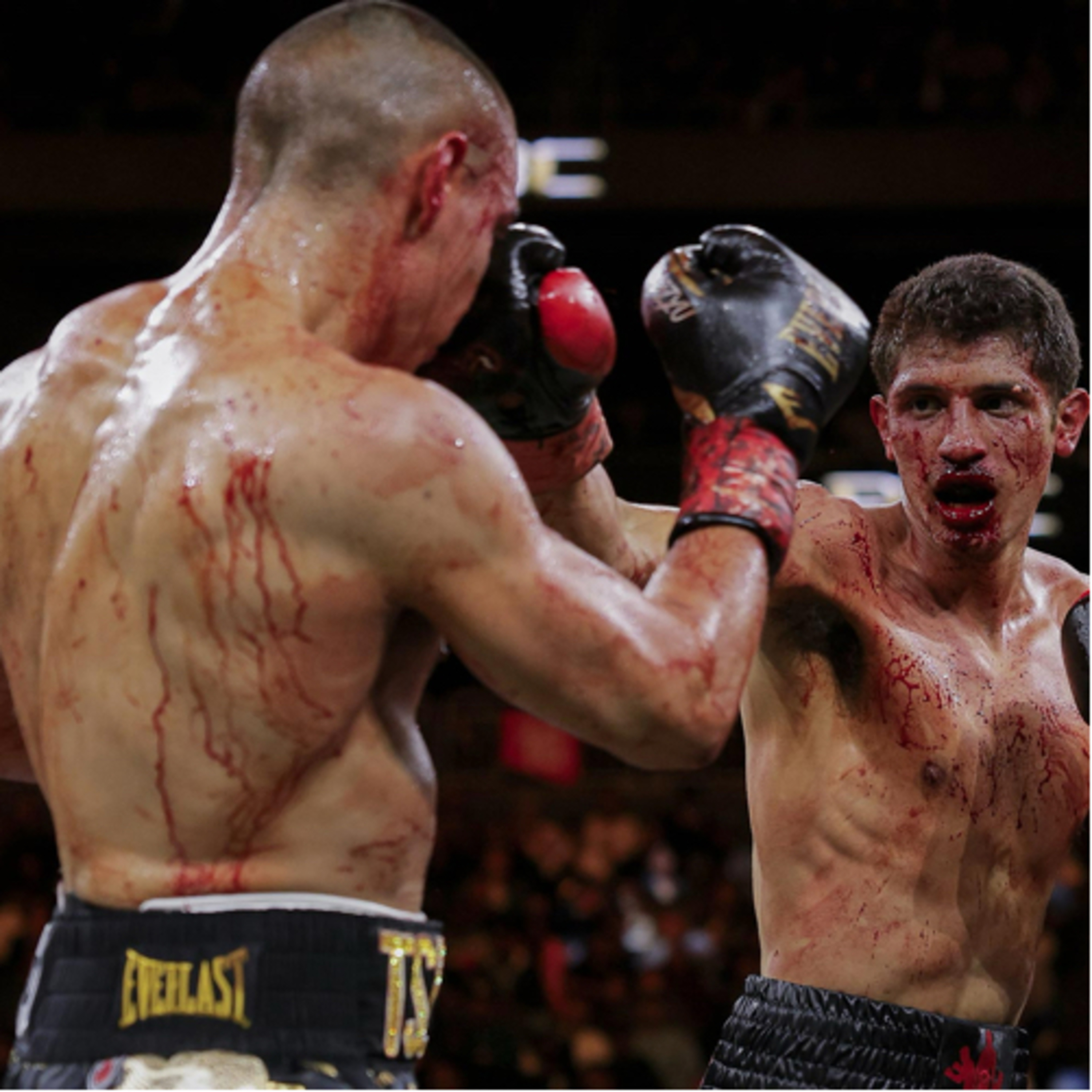Beyond the Gloves with Cedric Agnew