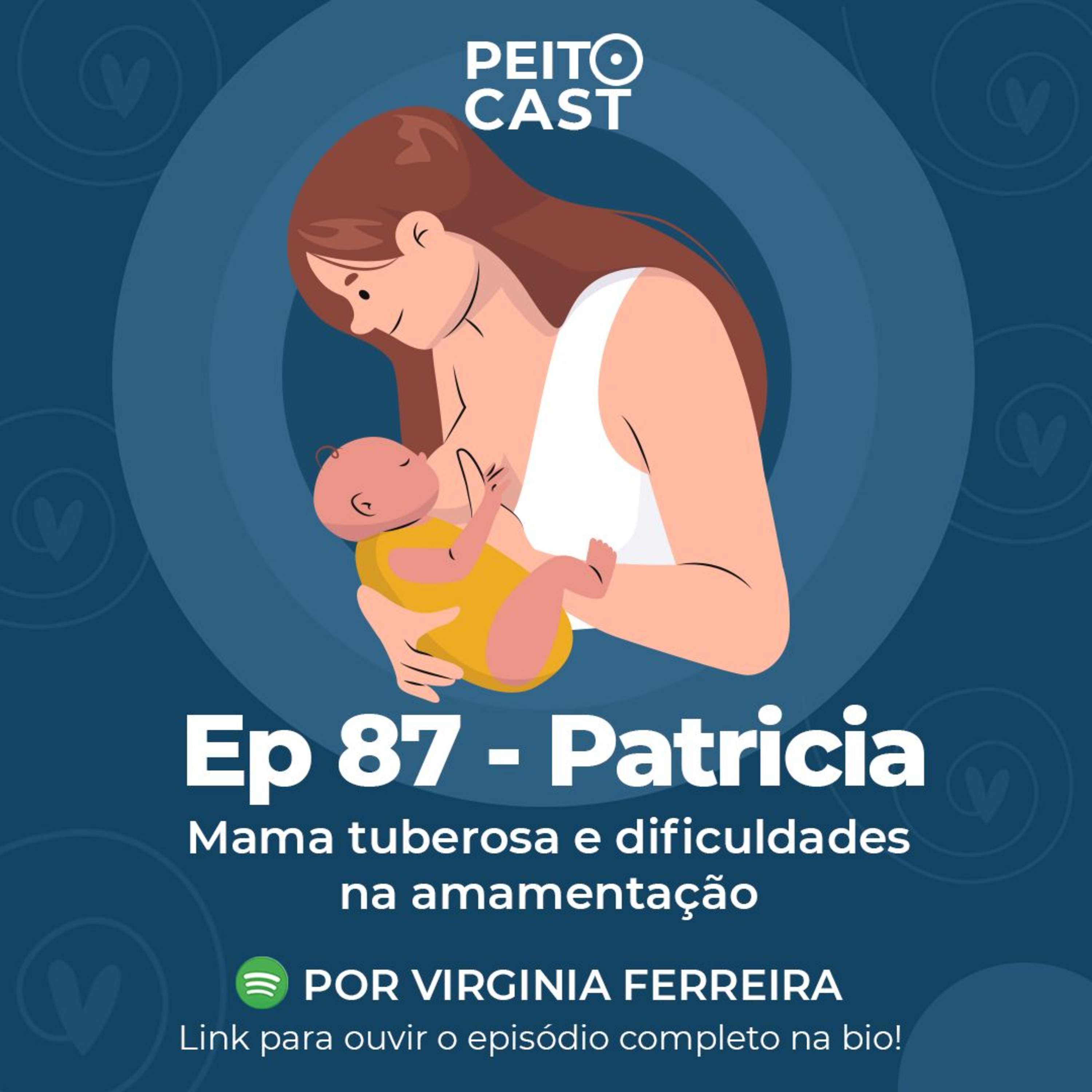 PeitoCast