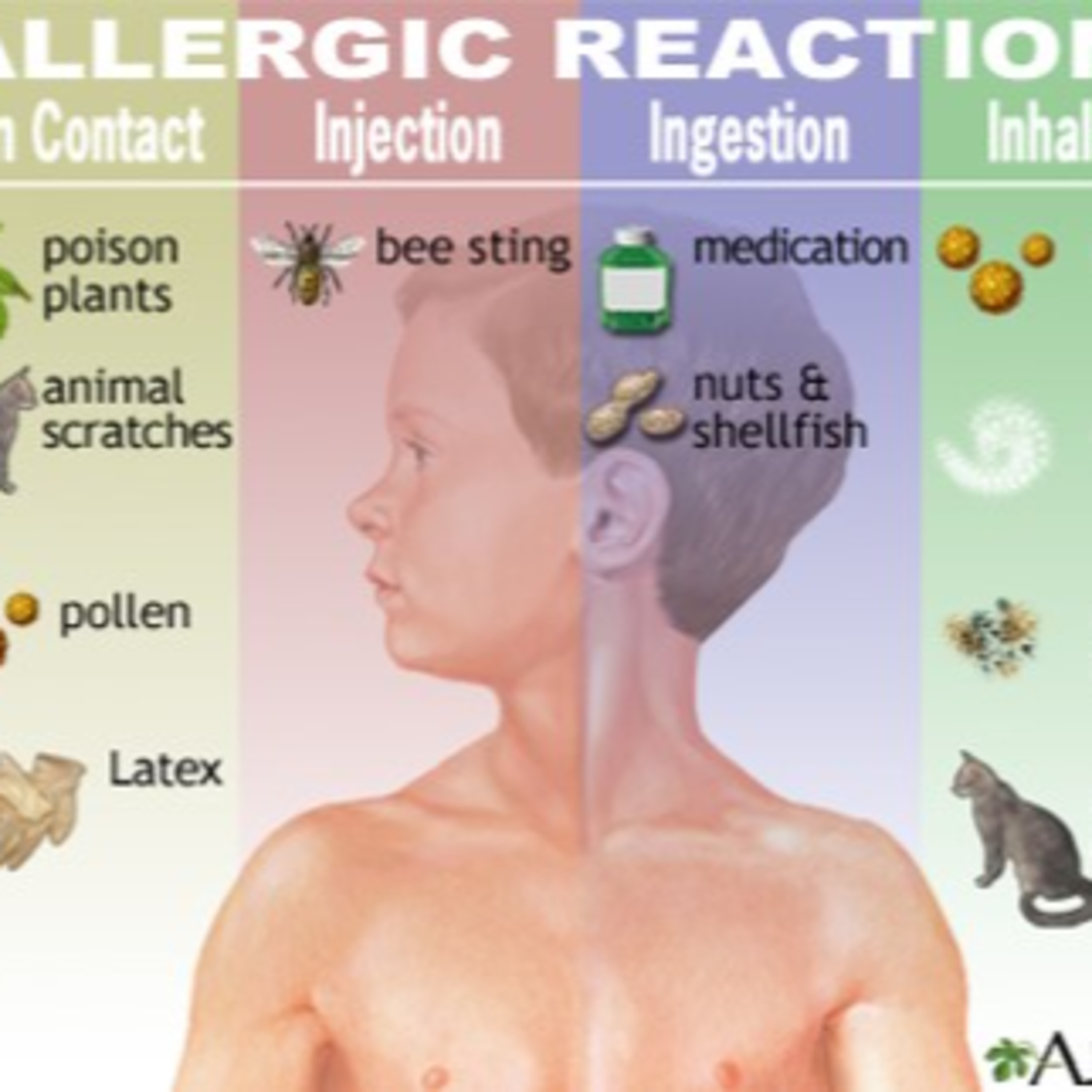 cover of episode Allergies and Hypersensitivity