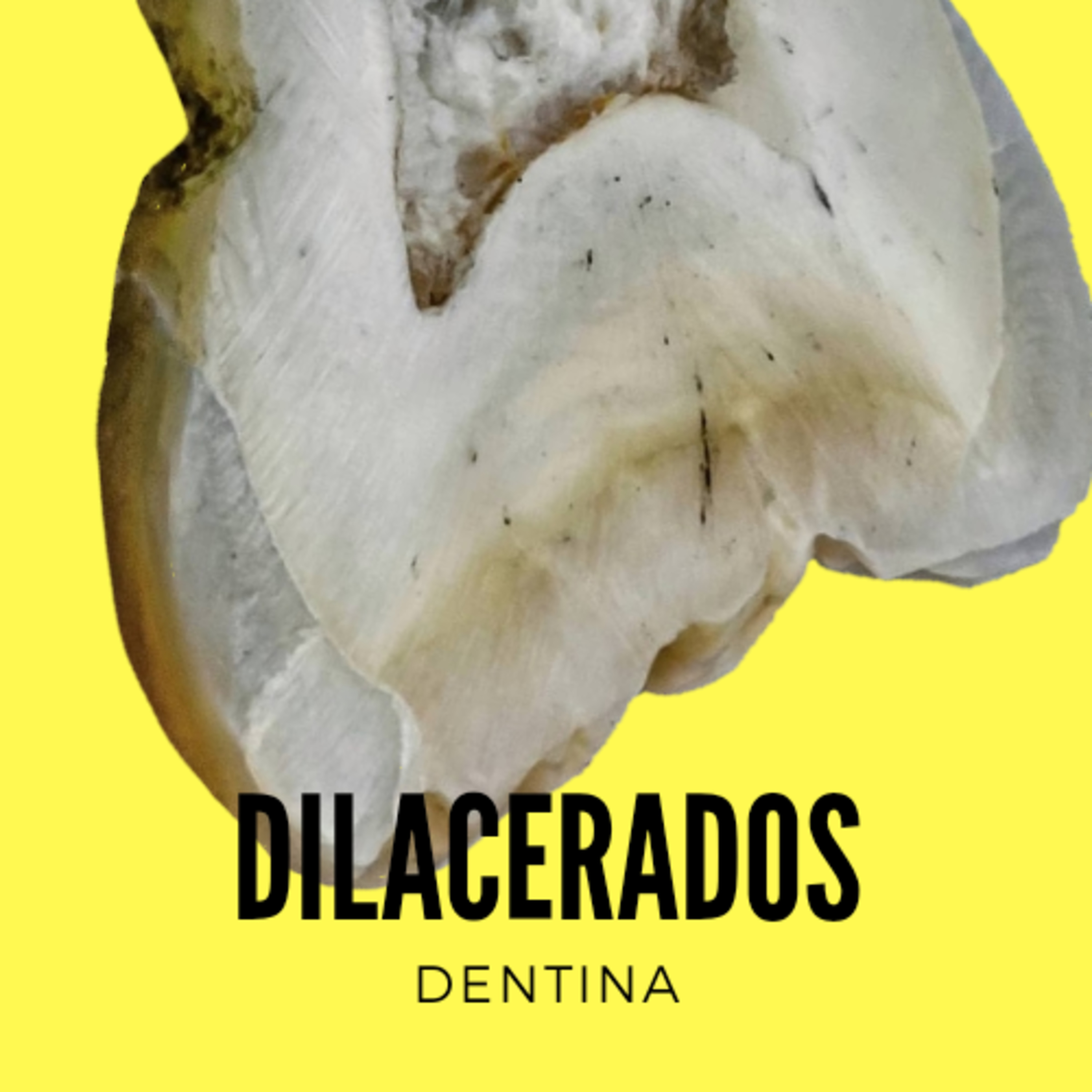 Dentina episode artwork