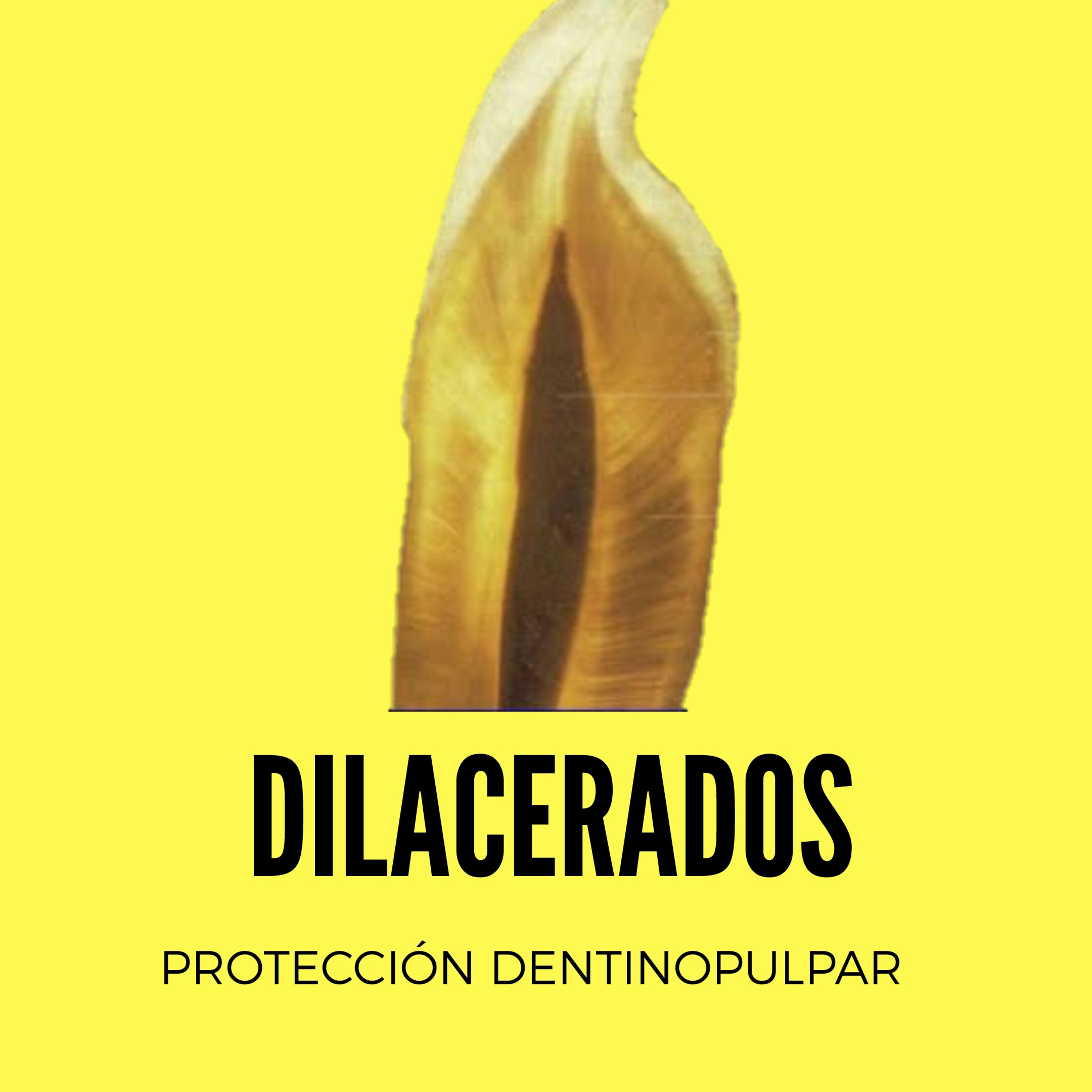 Protección Dentinopulpar Directa episode artwork