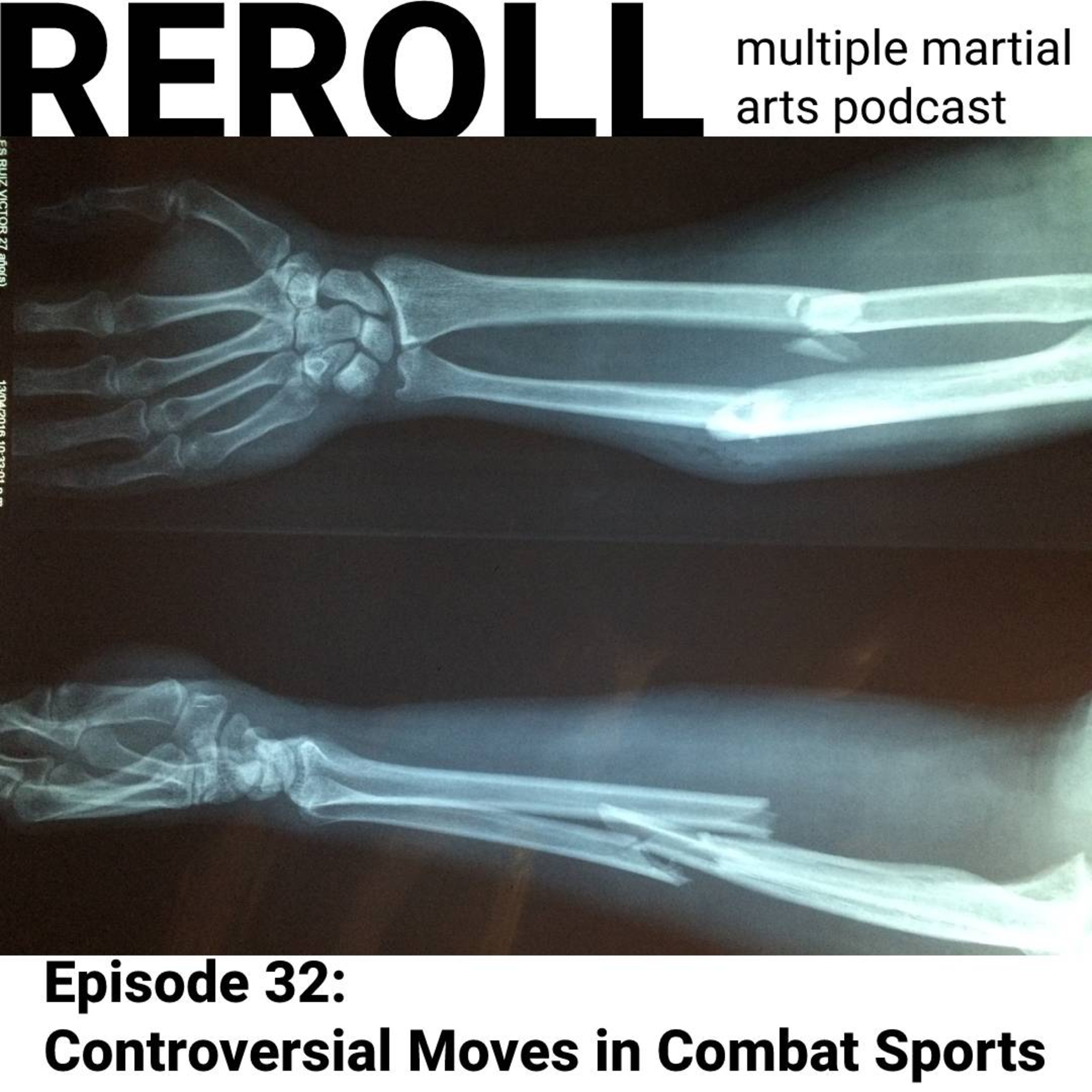 Reroll MMA