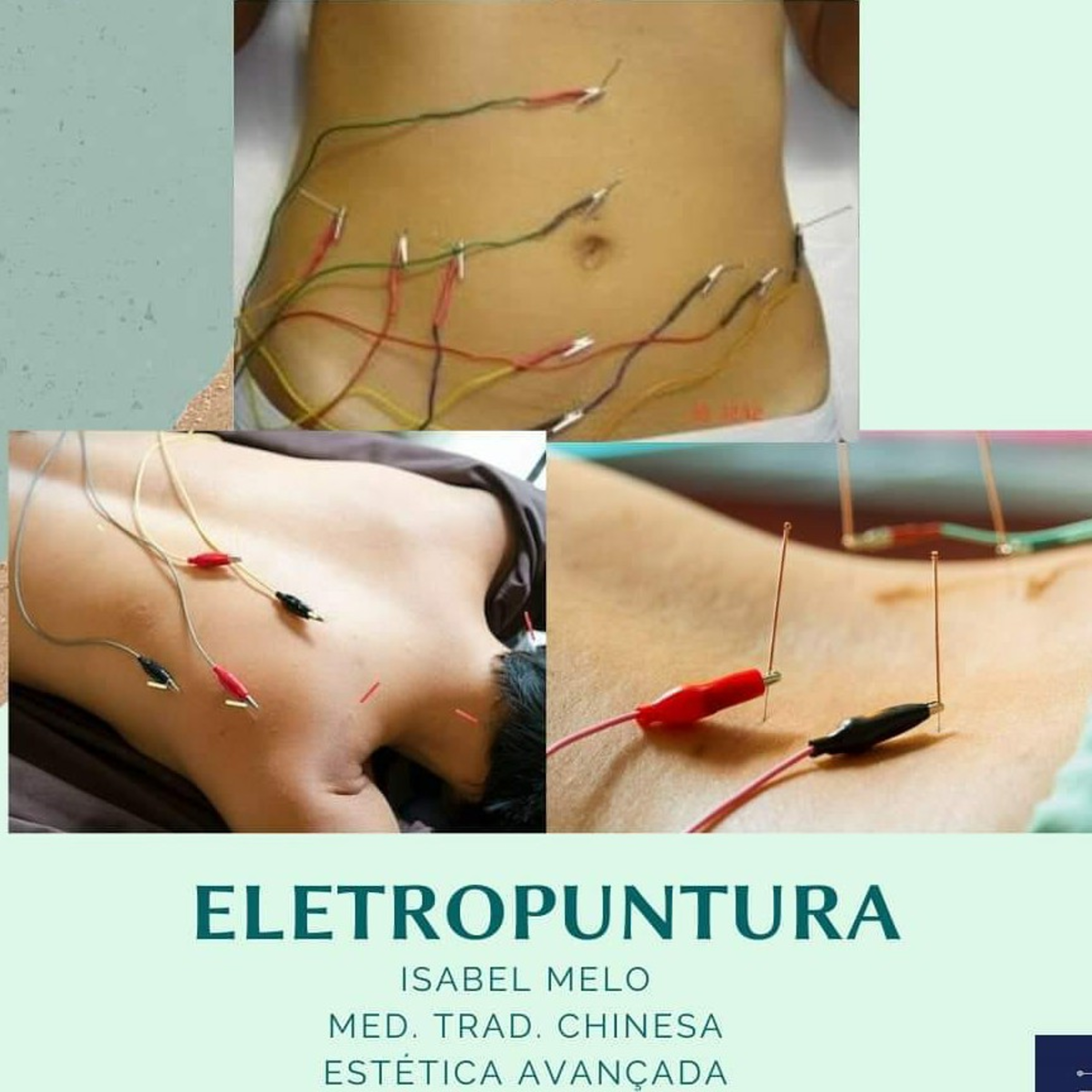 Isabel Melo (Med.T. Chinesa/Estética Avançada)