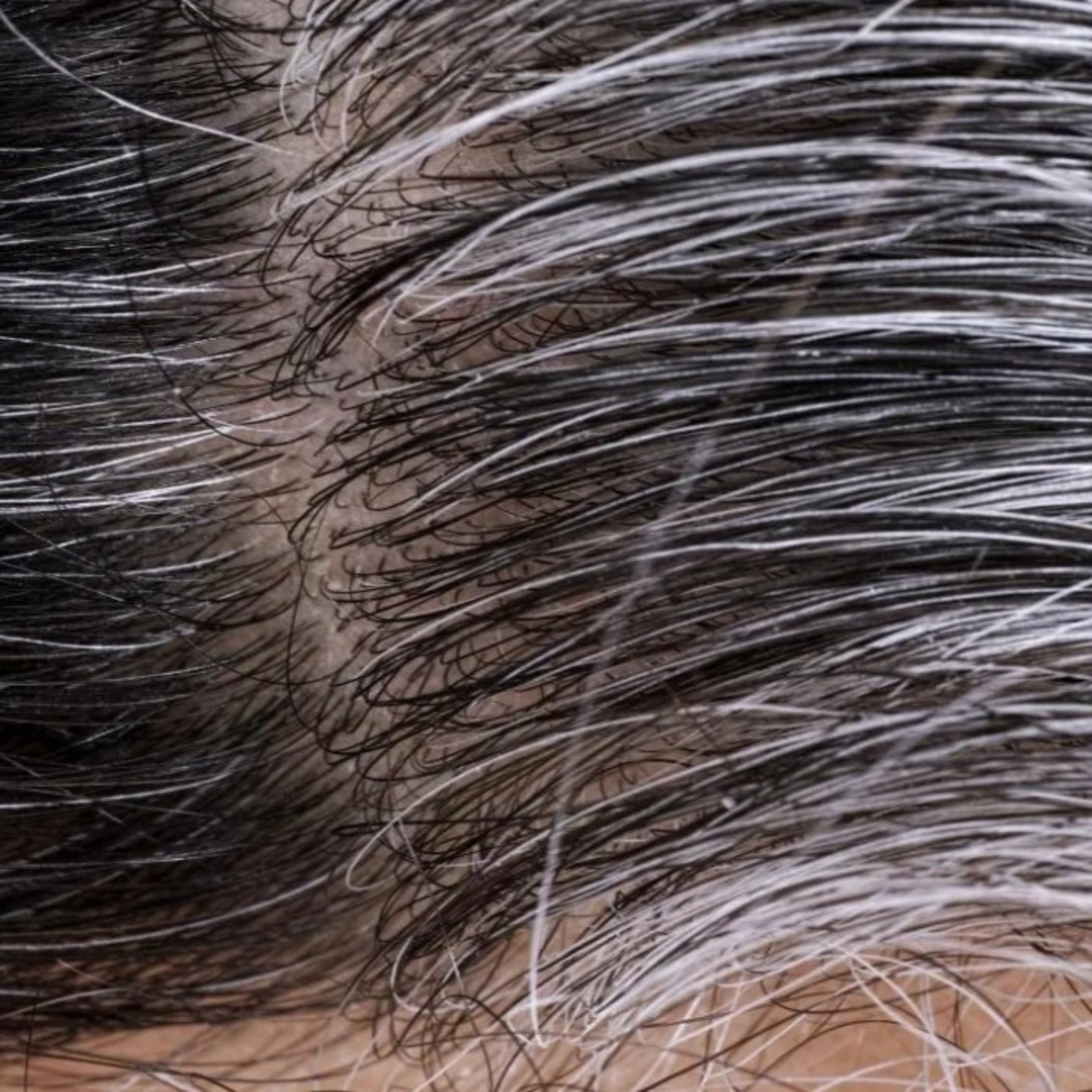 Grey hair can be reversed..!