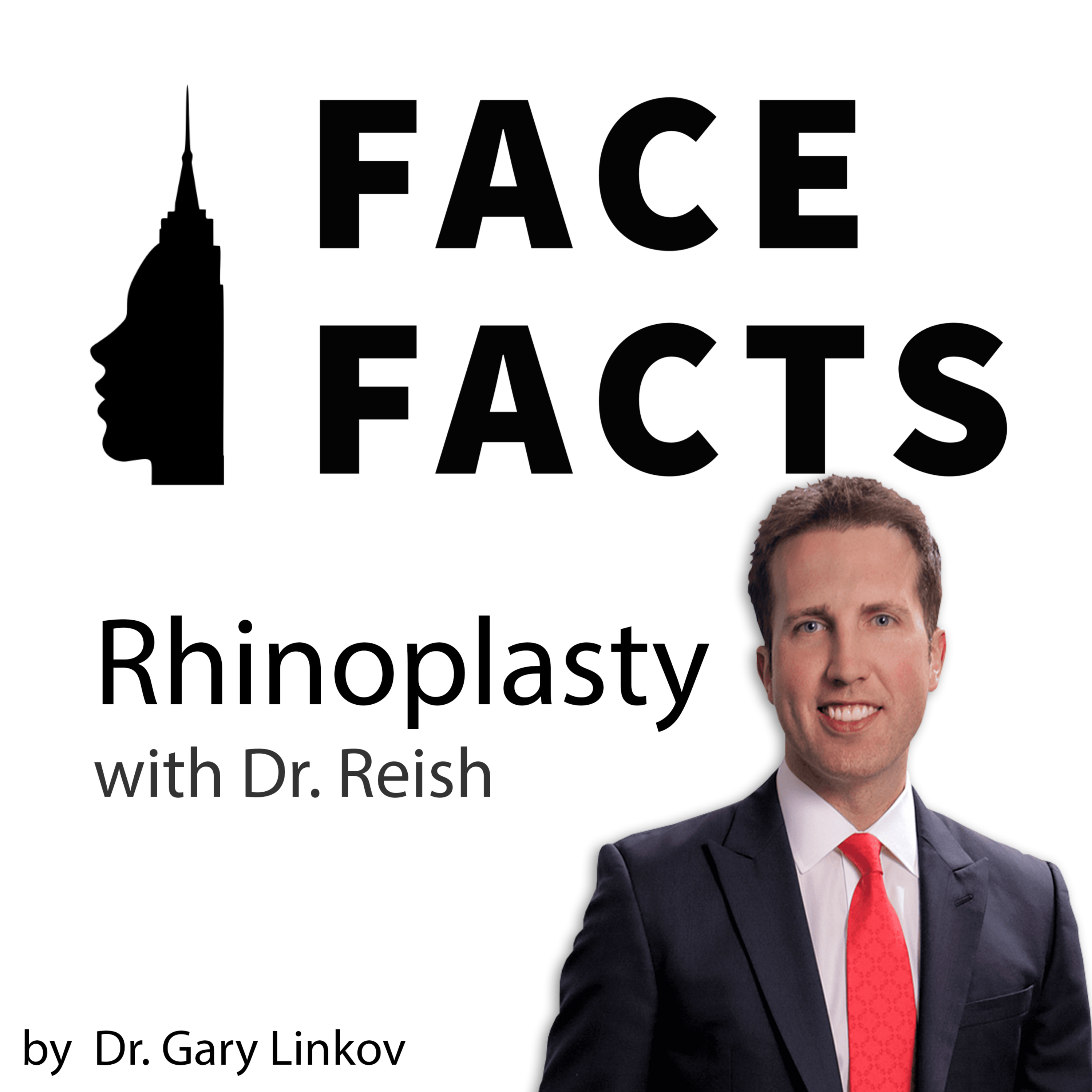 Face Facts