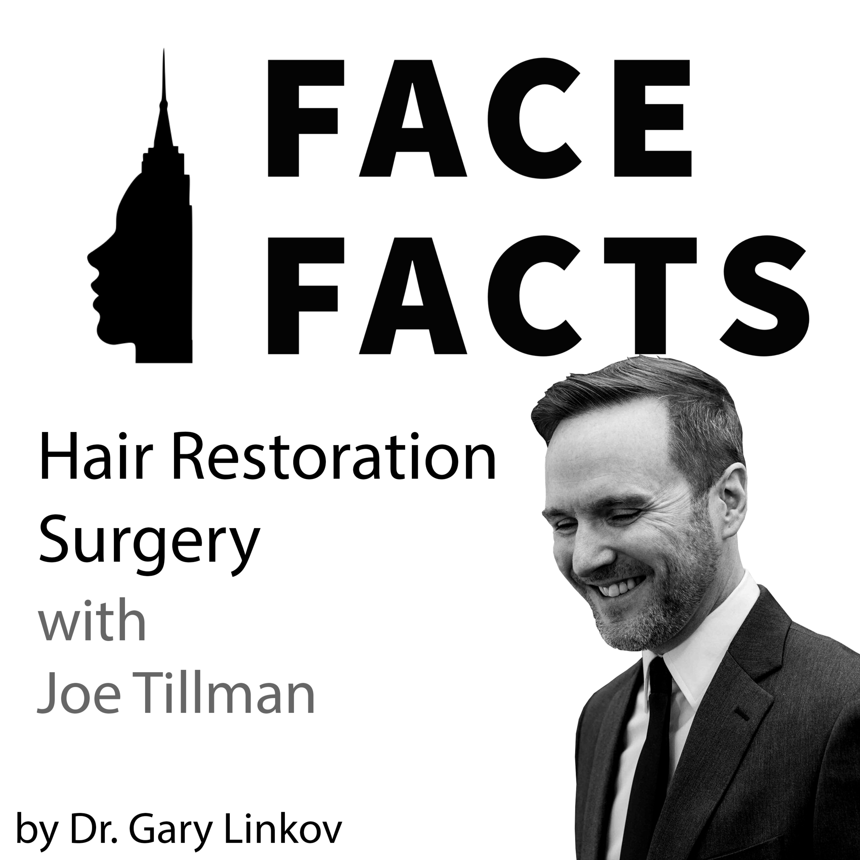 Face Facts