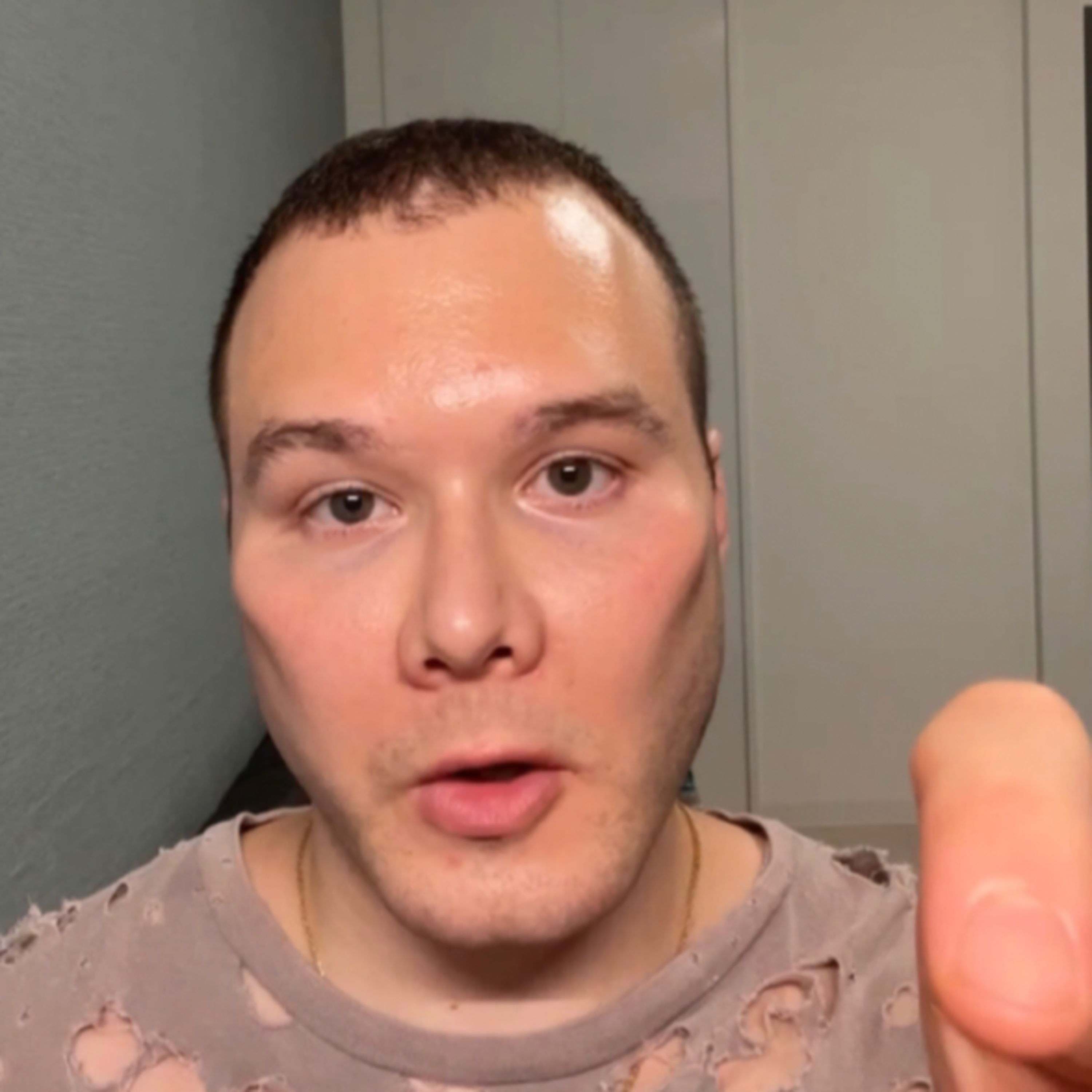 Acute tubular necrosis vs tubulointerstitial nephropathy in under 60 seconds