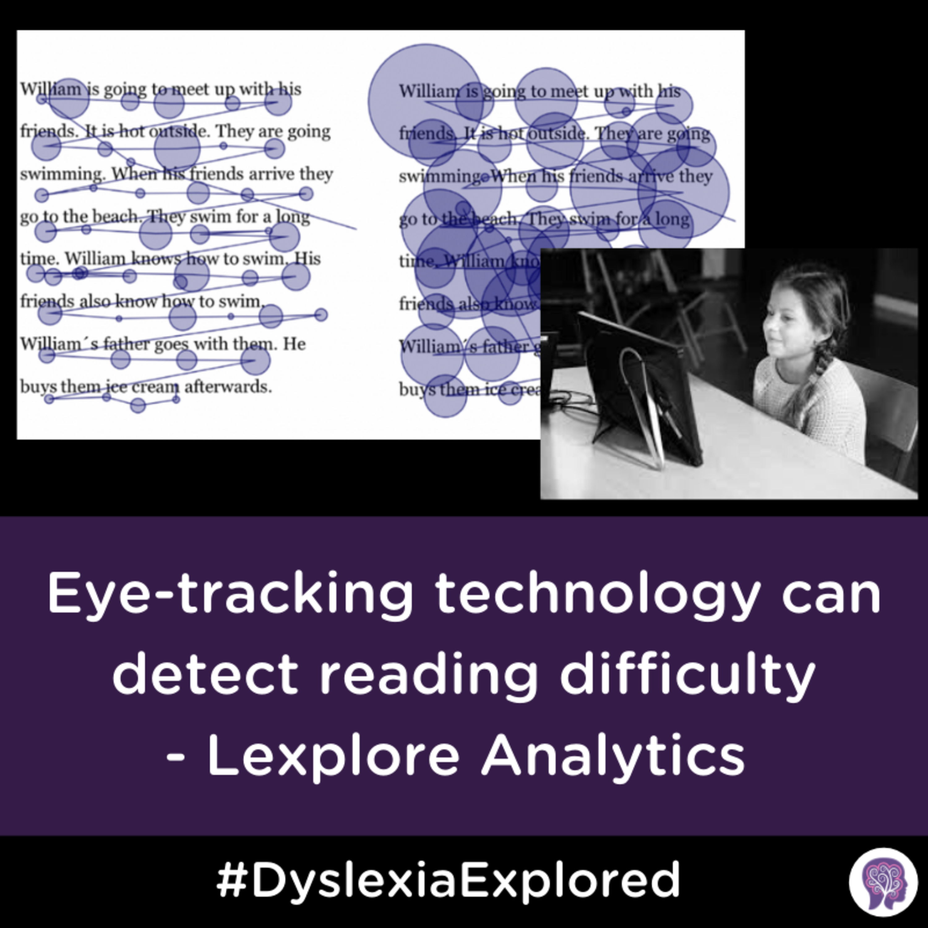 #47 Eye-tracking technology detects reading difficulty - Lexplore Analytics Presentation part 1 episode artwork
