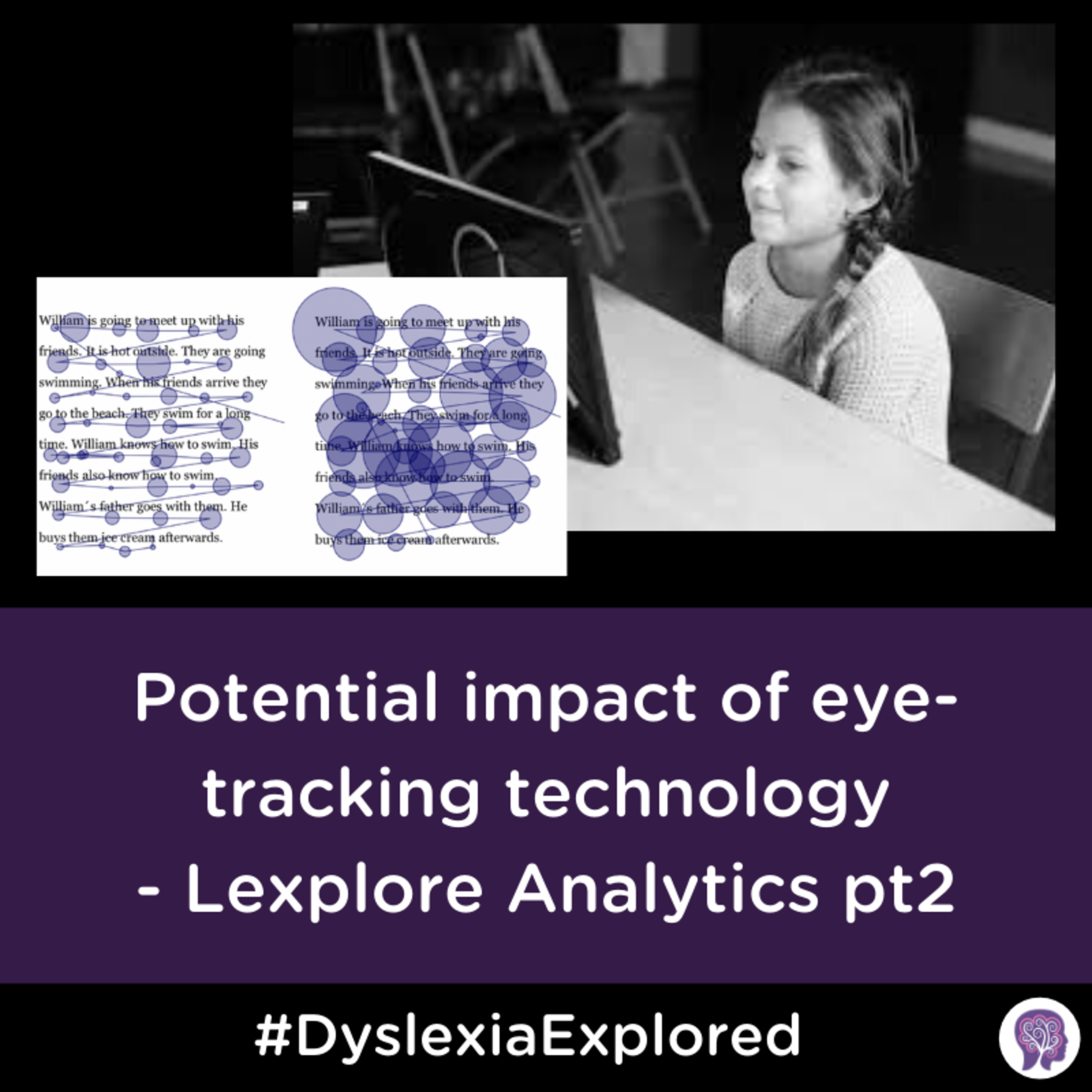#48 The Potential impacts of eye-tracking technology - Lexplore Analytics part 2 episode artwork