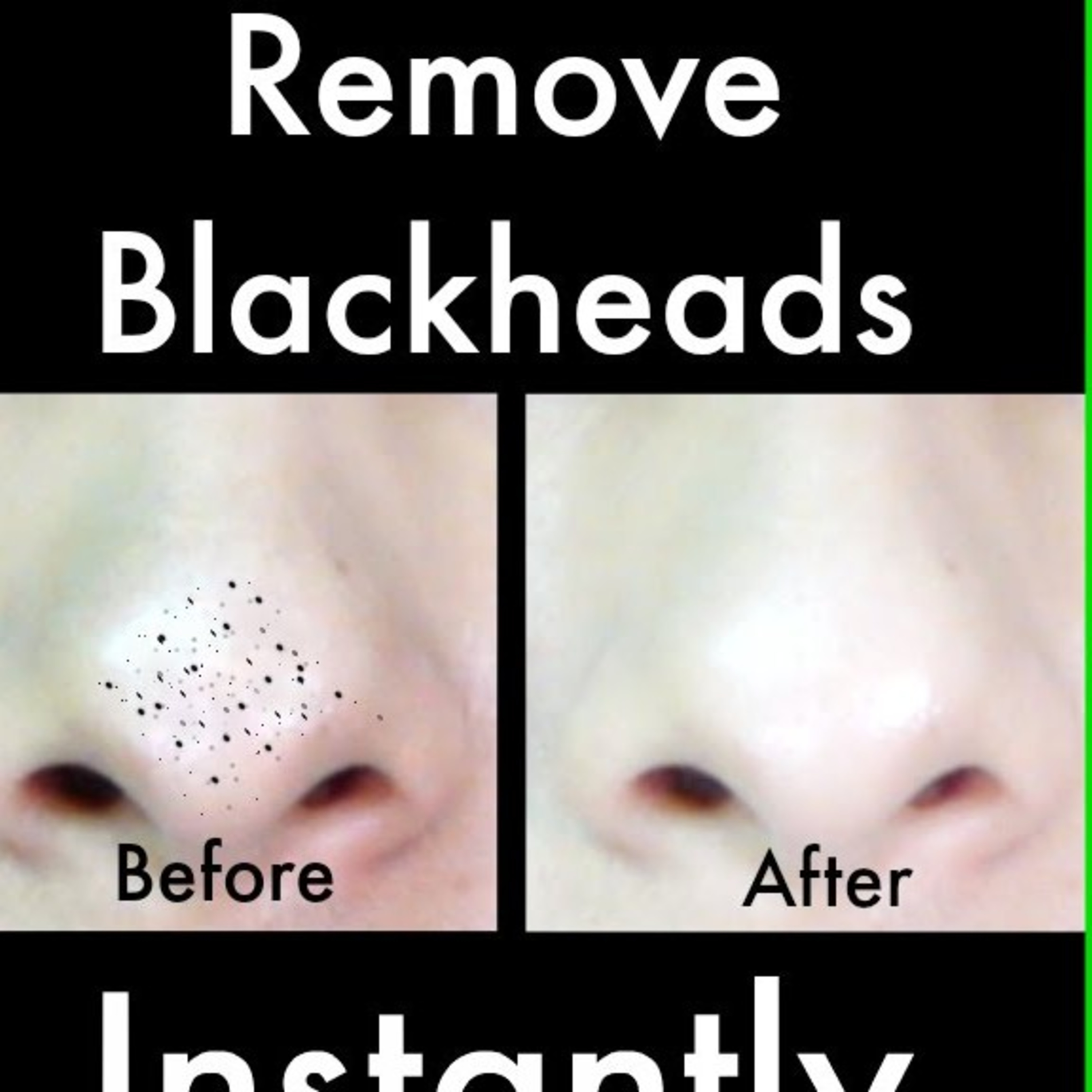 How to Remove Blackheads with Natural Remedies. episode artwork