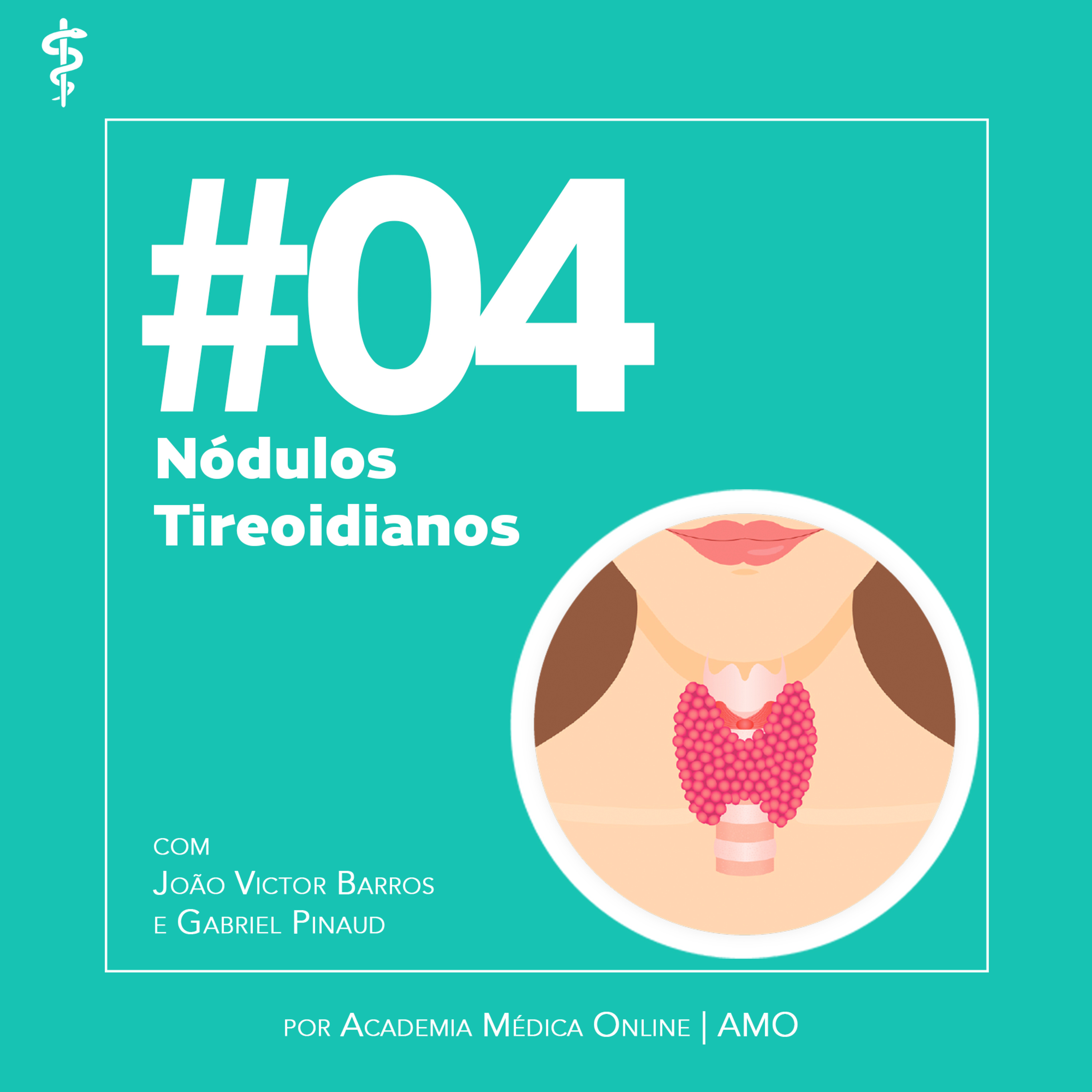 #04: Nódulos Tireoidianos