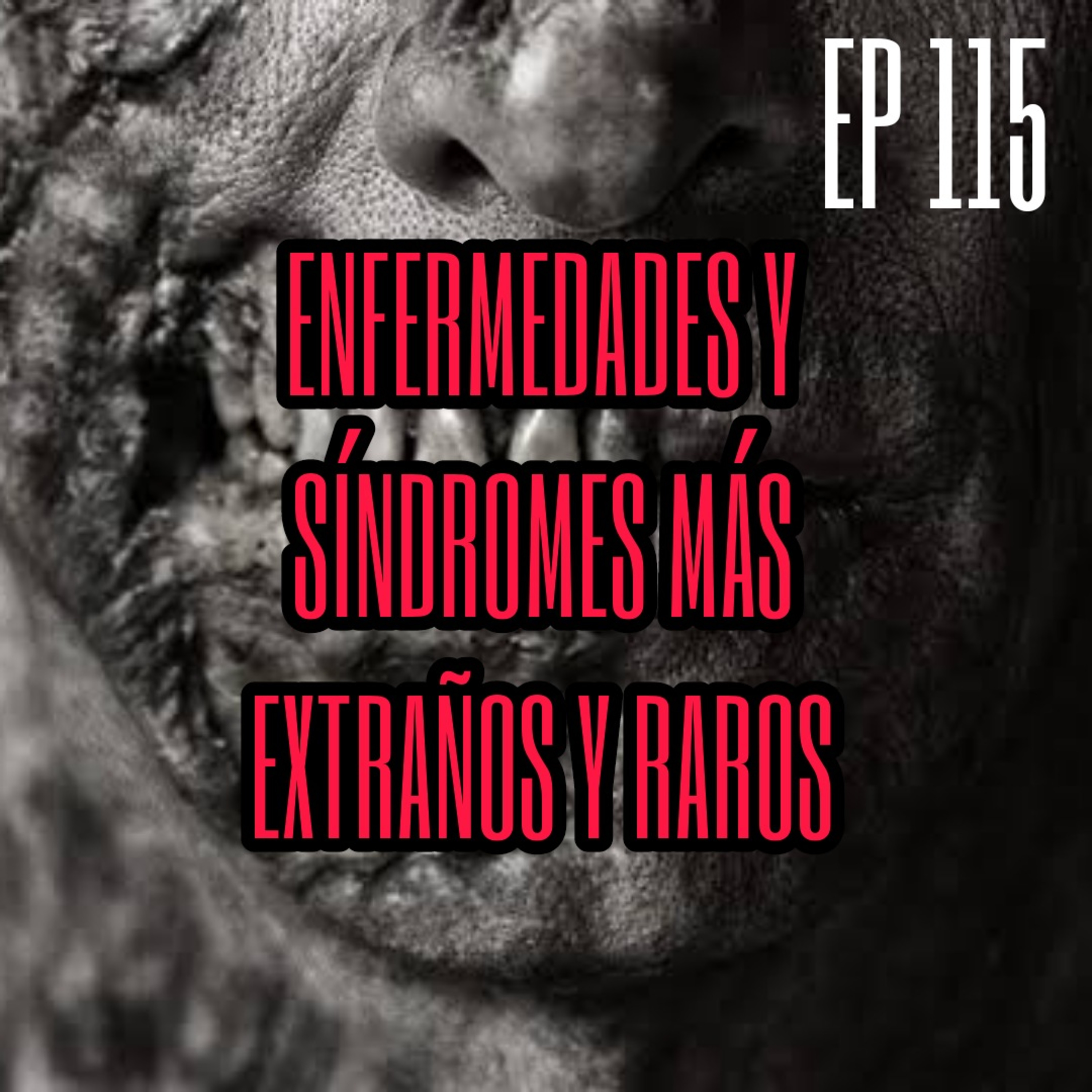 EP 115: Las ENFERMEDADES Y SINDROMES más EXTRAÑOS y RAR0S del MUNDO episode artwork