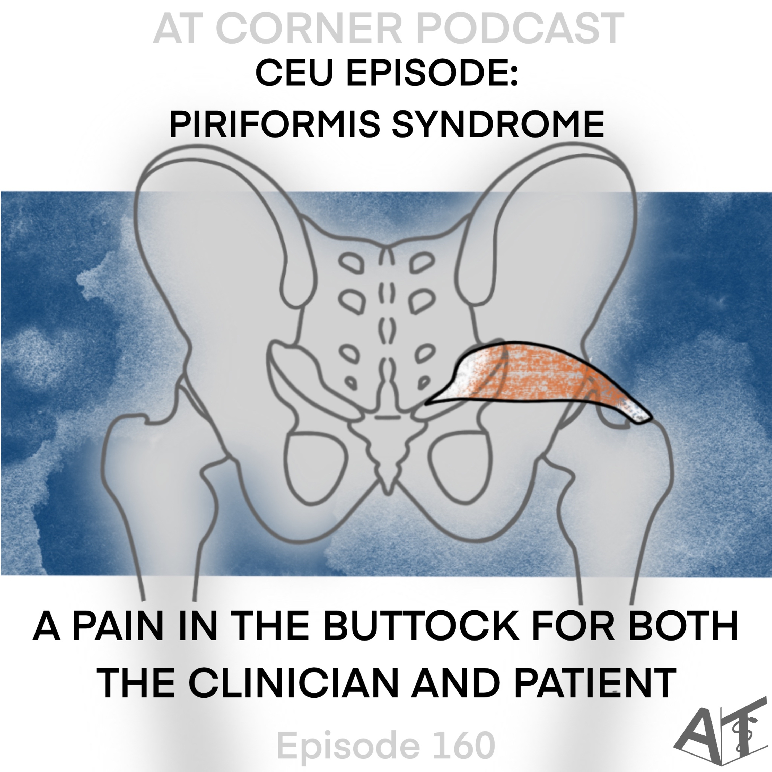 Piriformis Syndrome - A Pain in the Buttock for Both the Clinician and Patient - 160