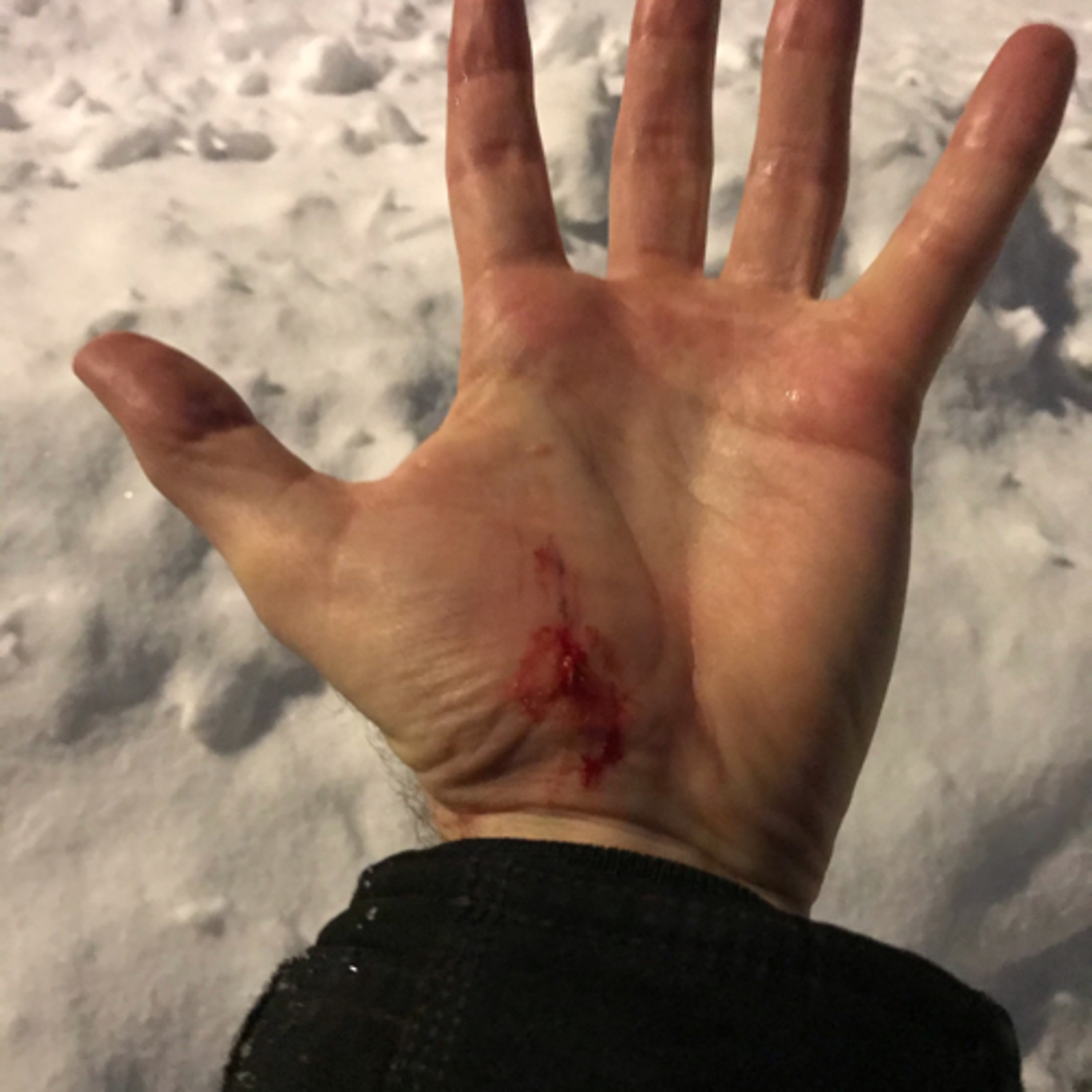 Battle Scars