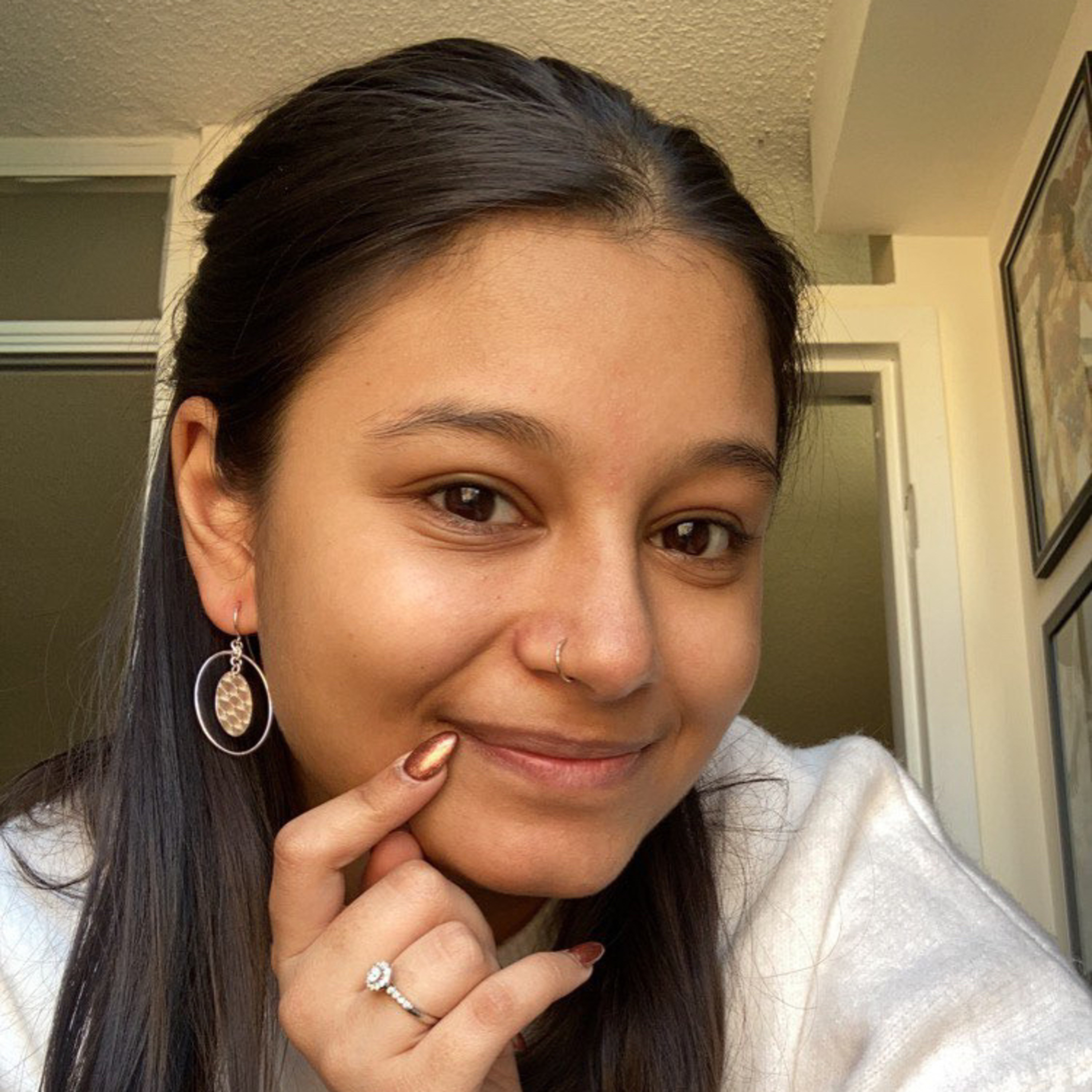 Episode 83 - You are unique in the universe Psoriatic arthritis with Aleina 