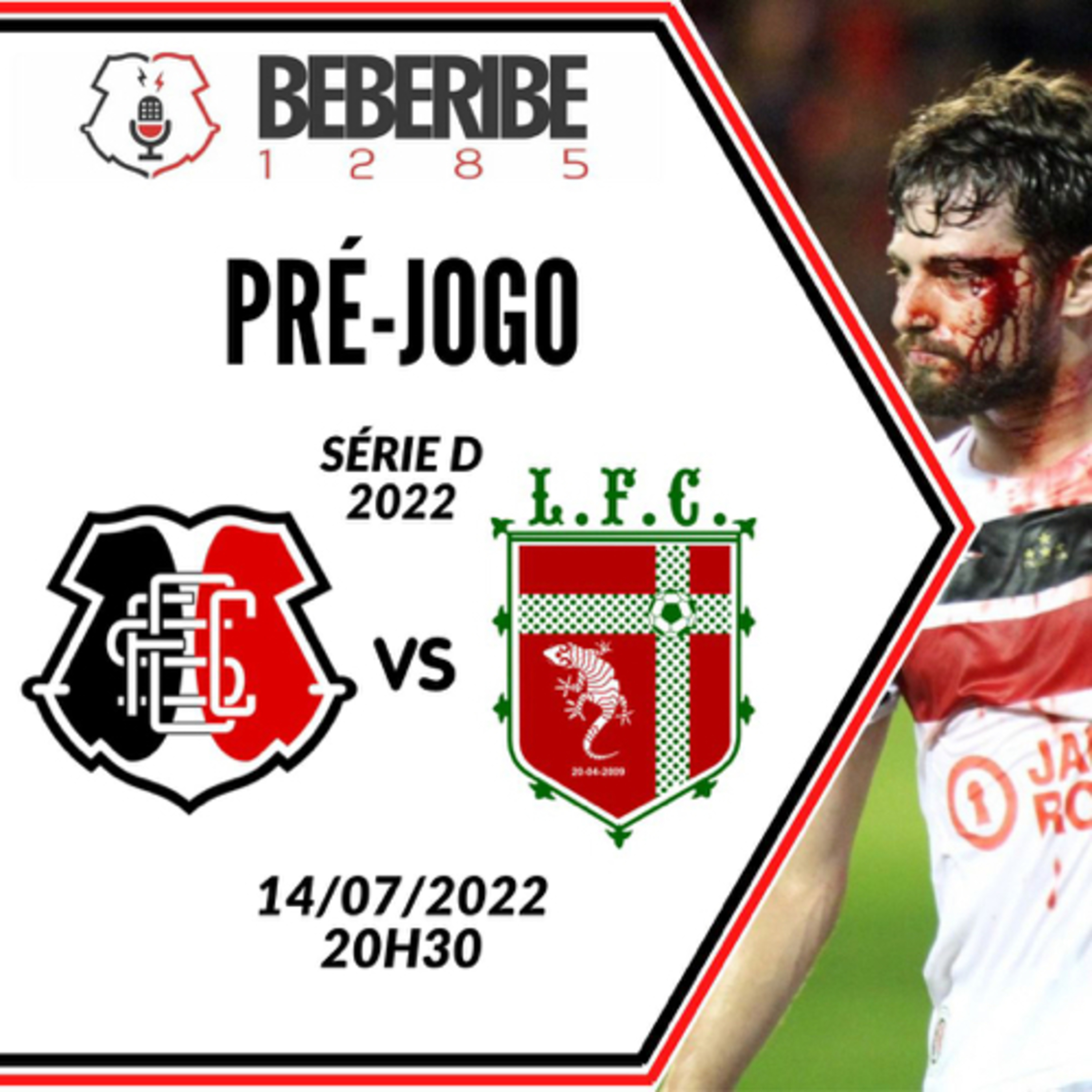#243 - Pré-Jogo do Beberibe - Santa Cruz x Lagarto - BR 2022 episode artwork