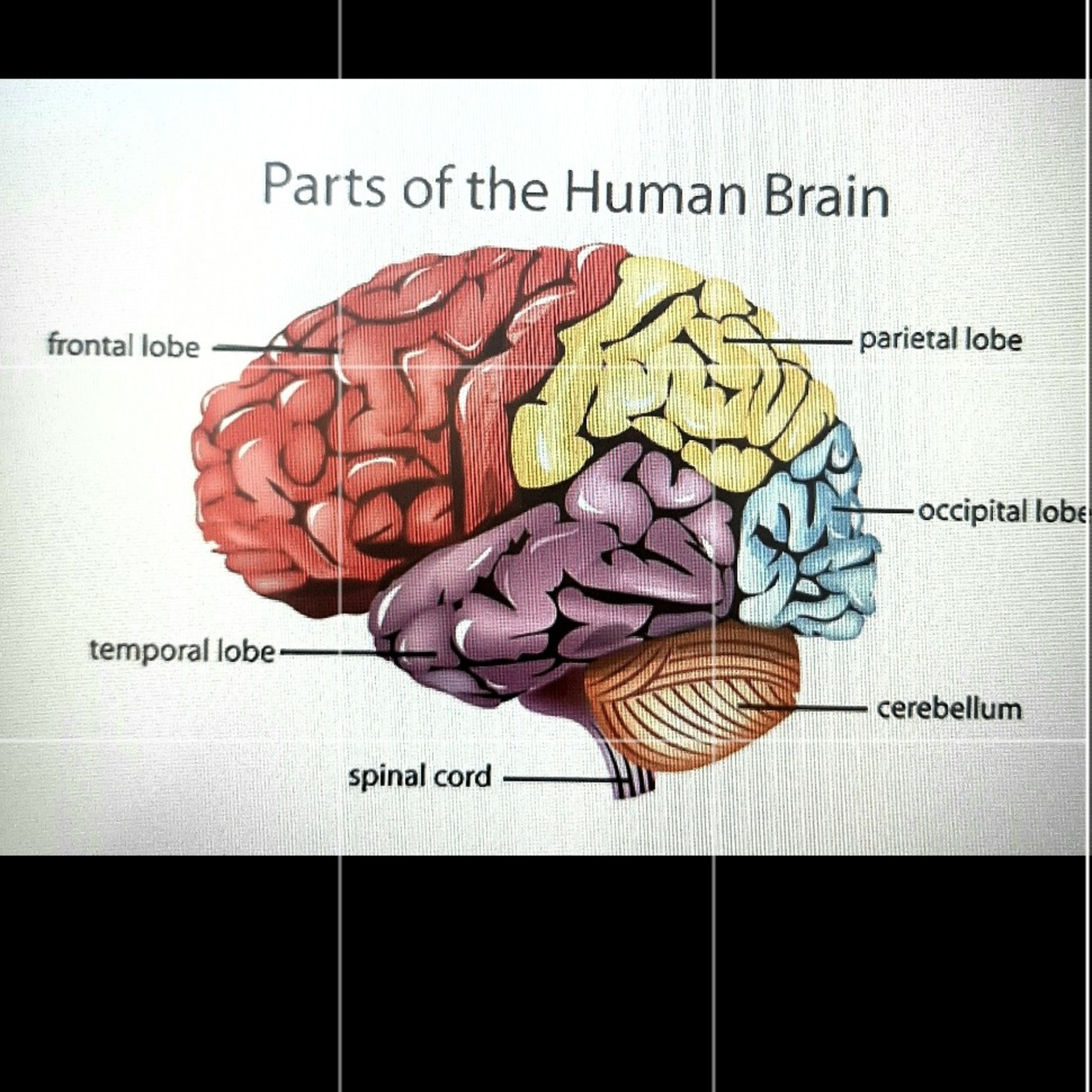 لوب فرونتال مغزت غوغا به پا میکنه فقط باید ازش بخوای
