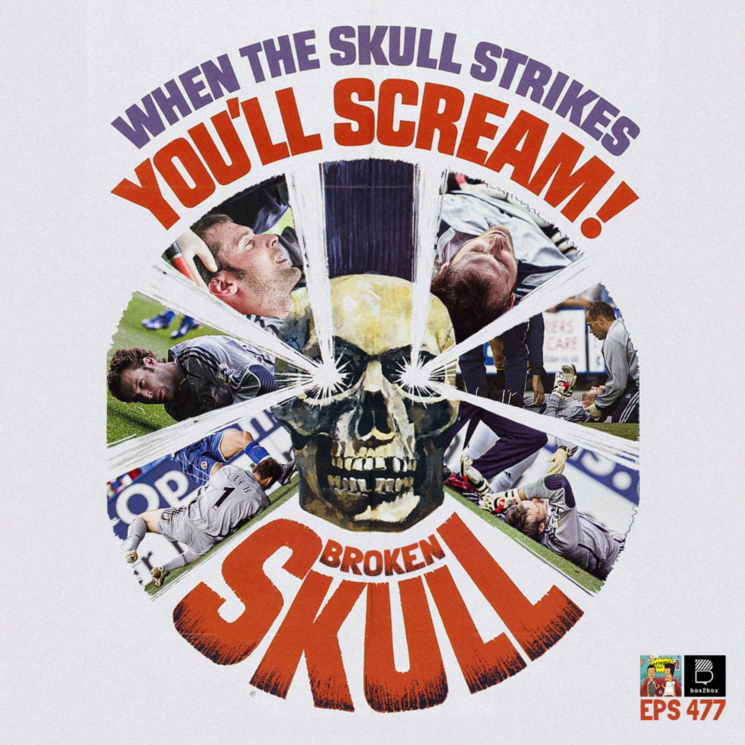 Eps 477: Kiper-kiper Dadakan