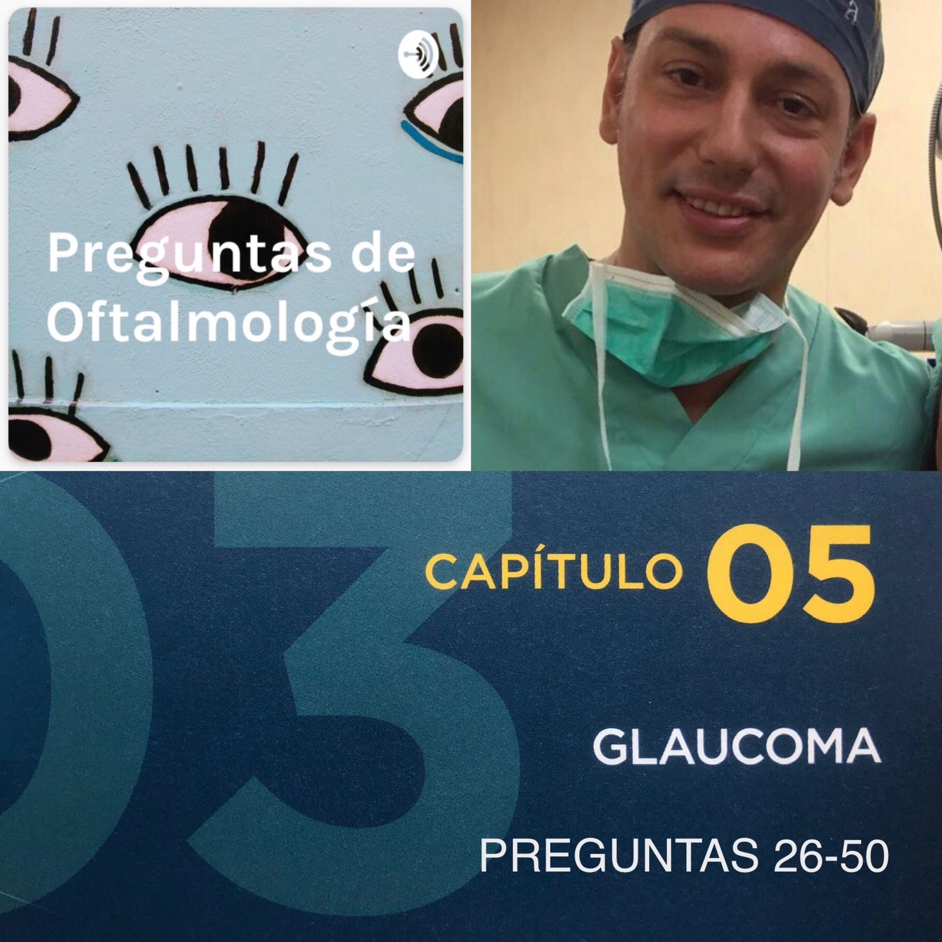 Preguntas de Oftalmología