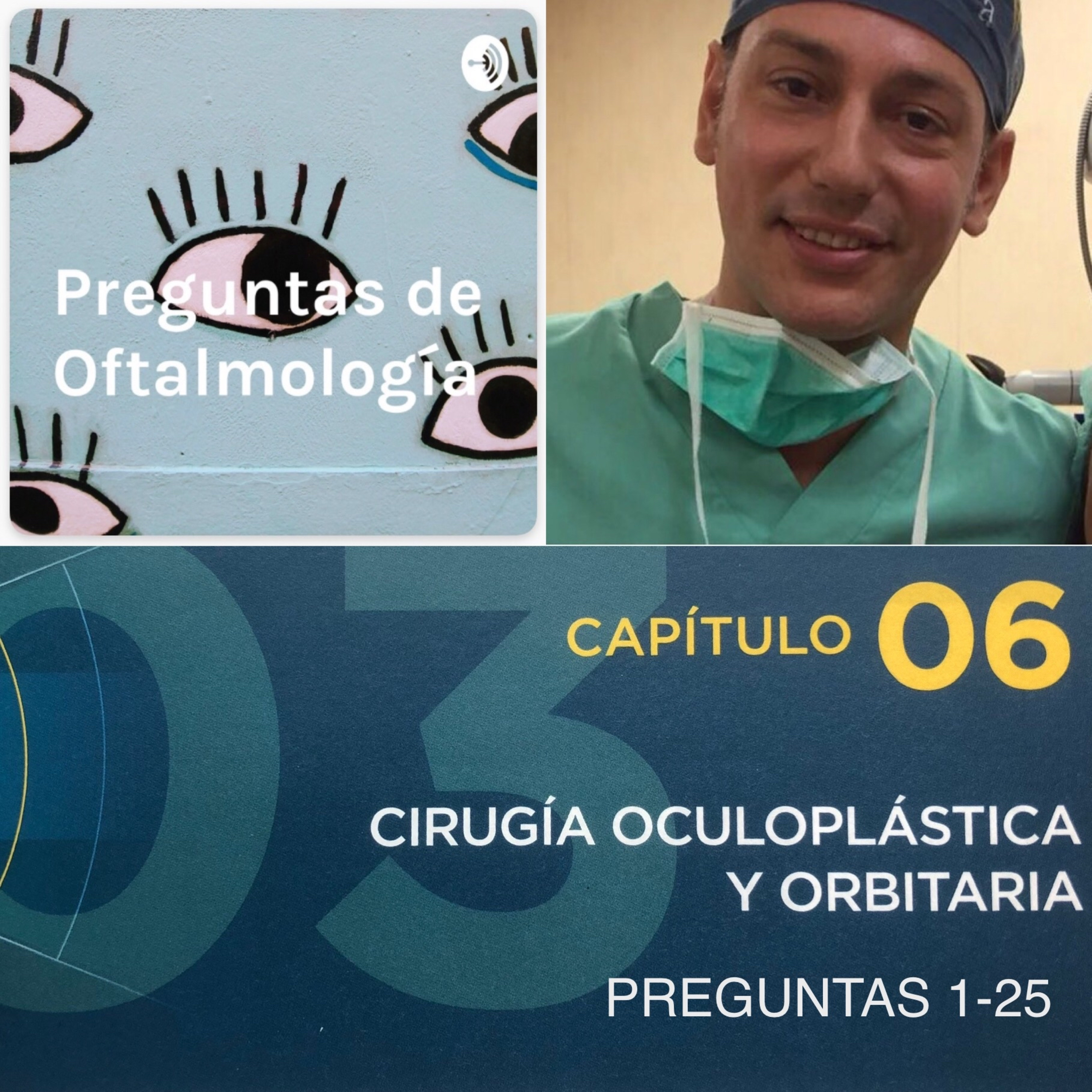 Preguntas de Oftalmología