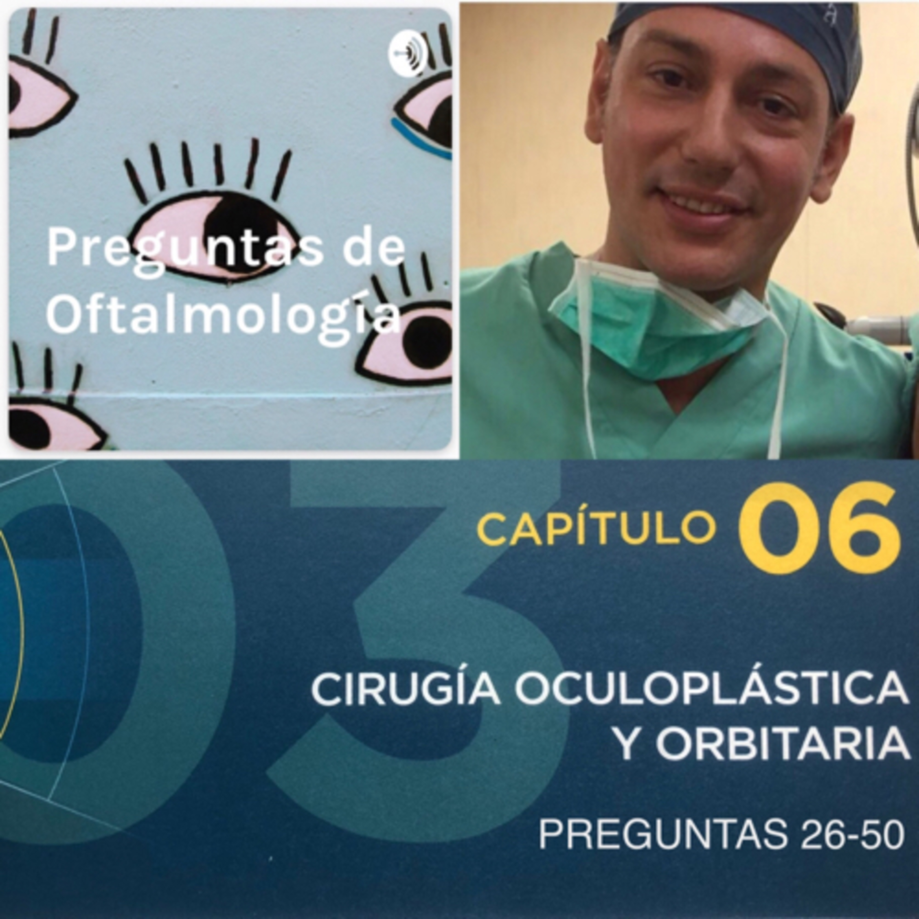 Preguntas de Oftalmología