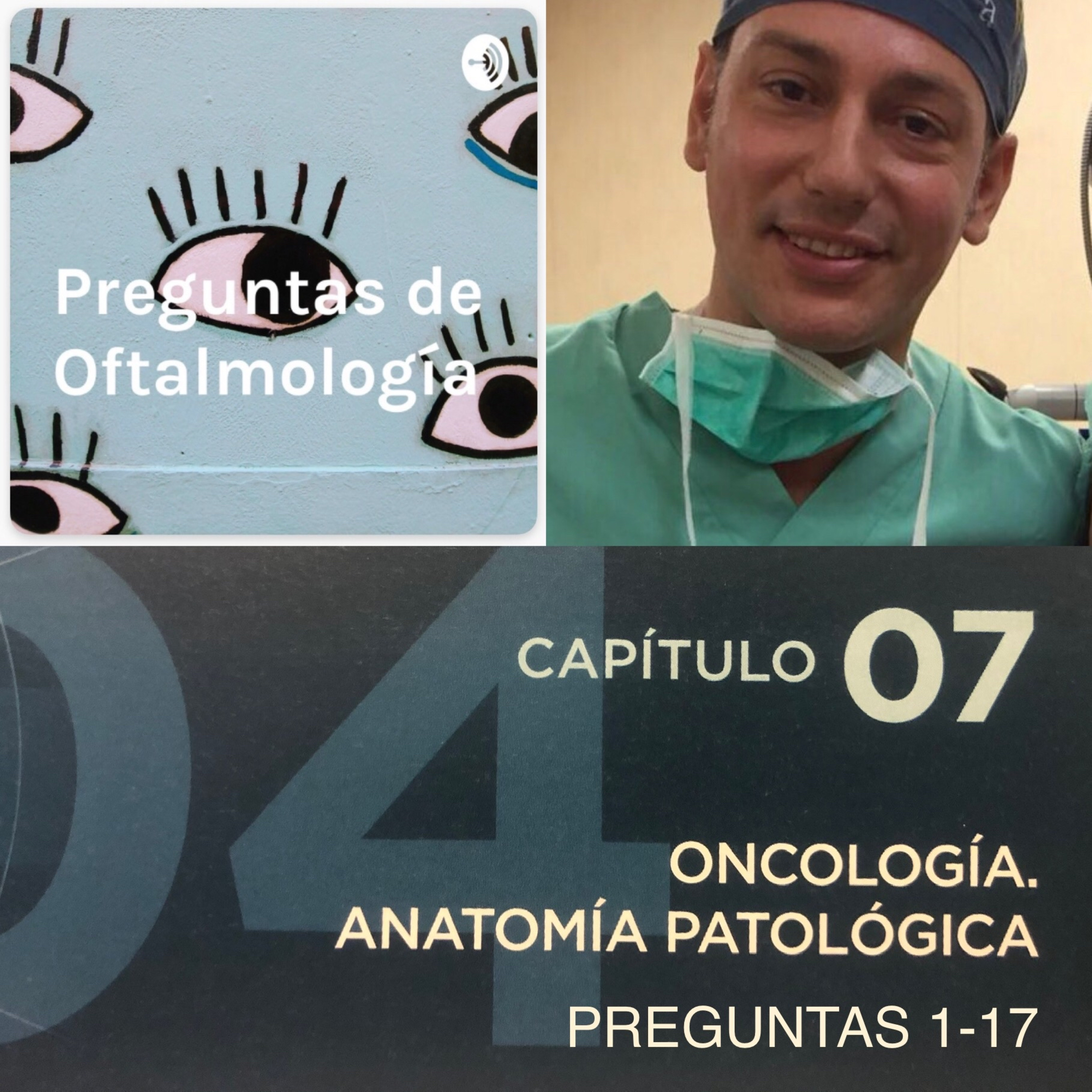 Preguntas de Oftalmología