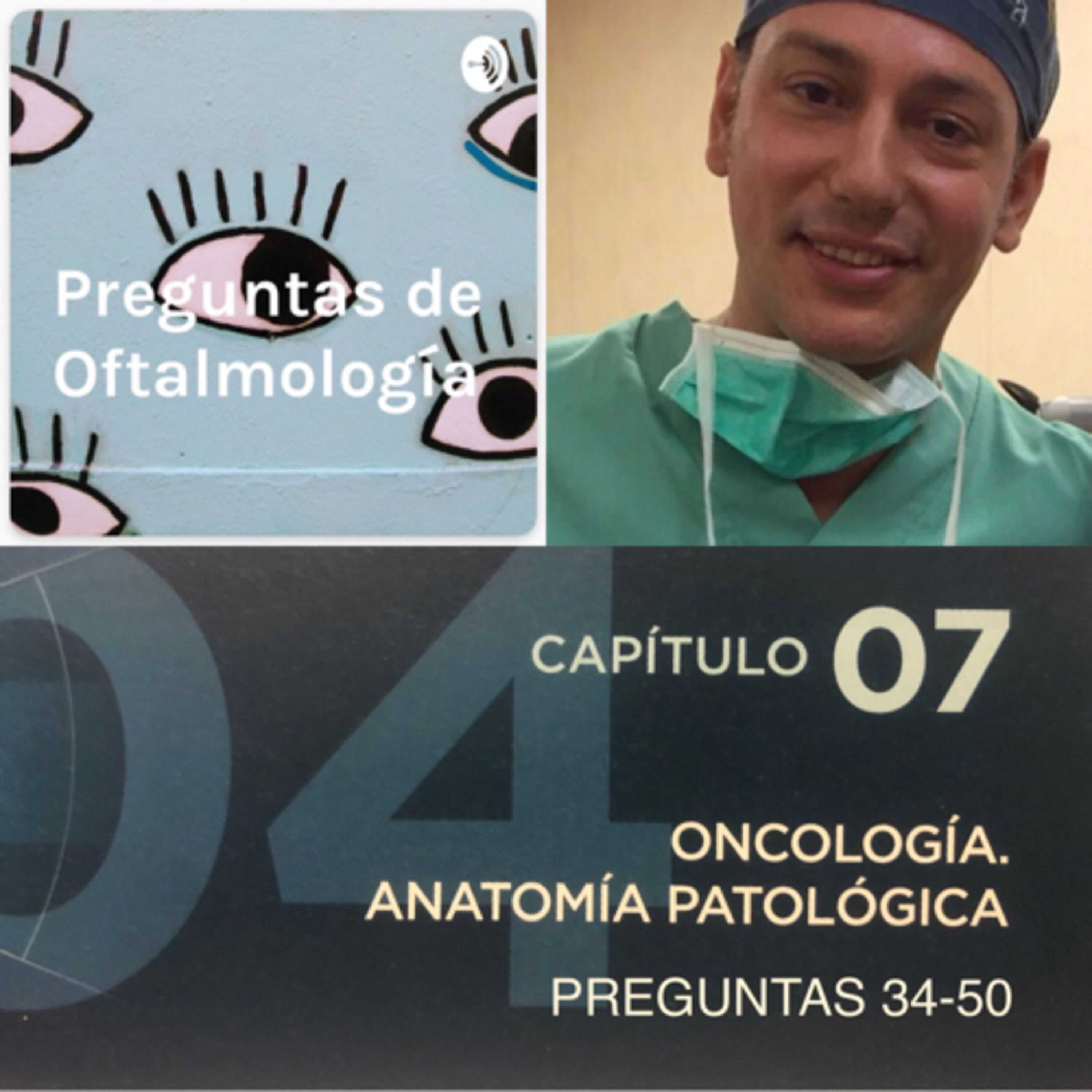 Preguntas de Oftalmología