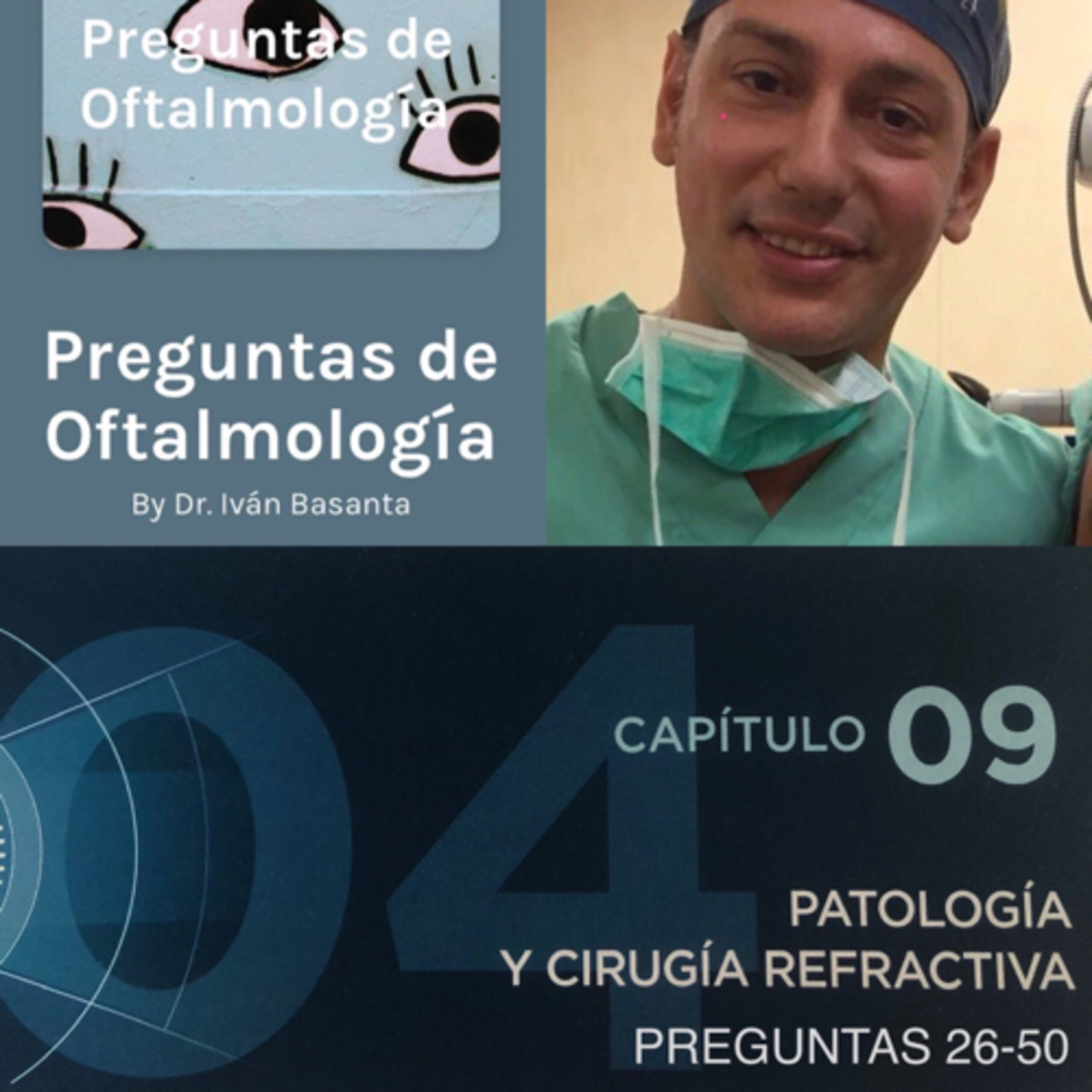 Preguntas de Oftalmología
