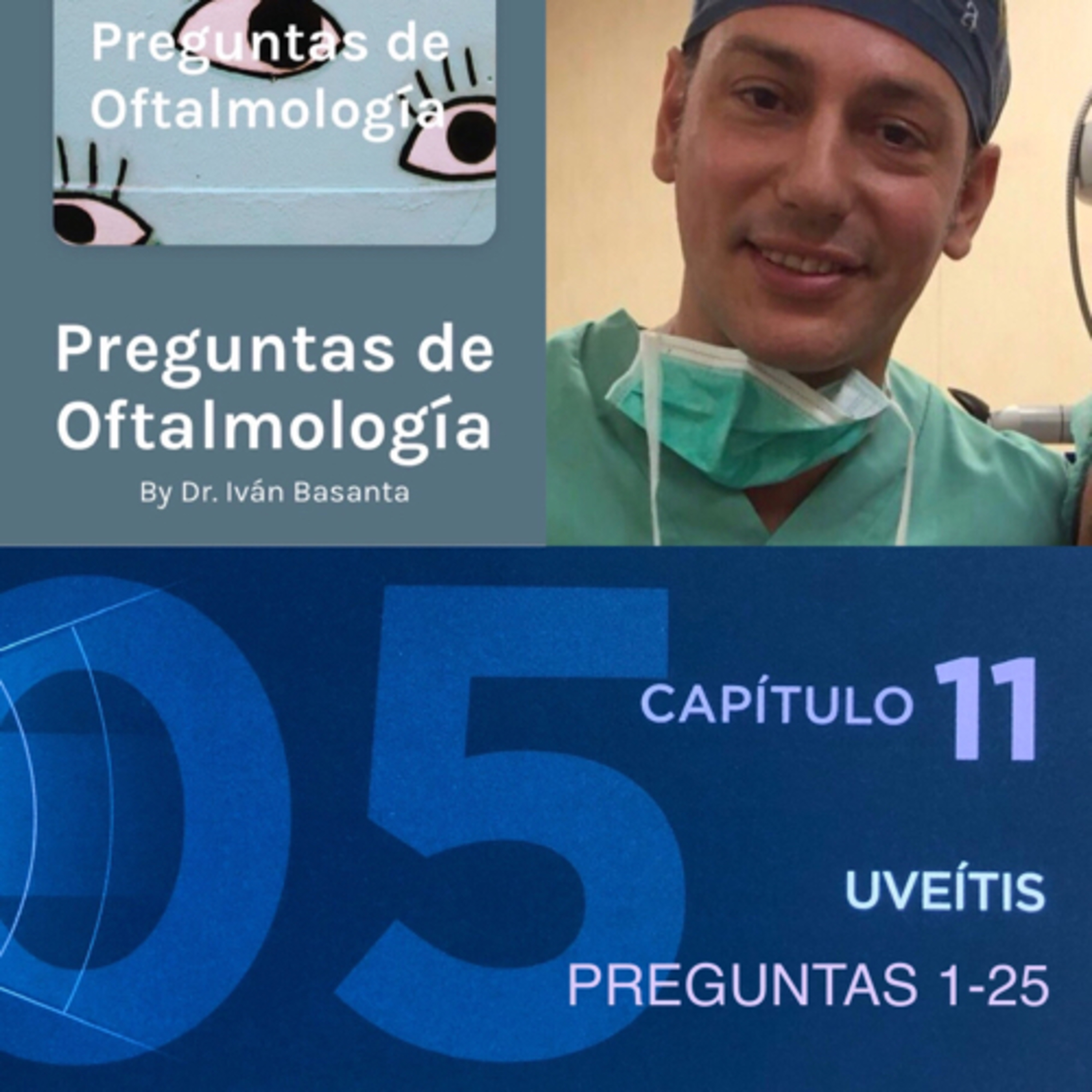 Preguntas de Oftalmología