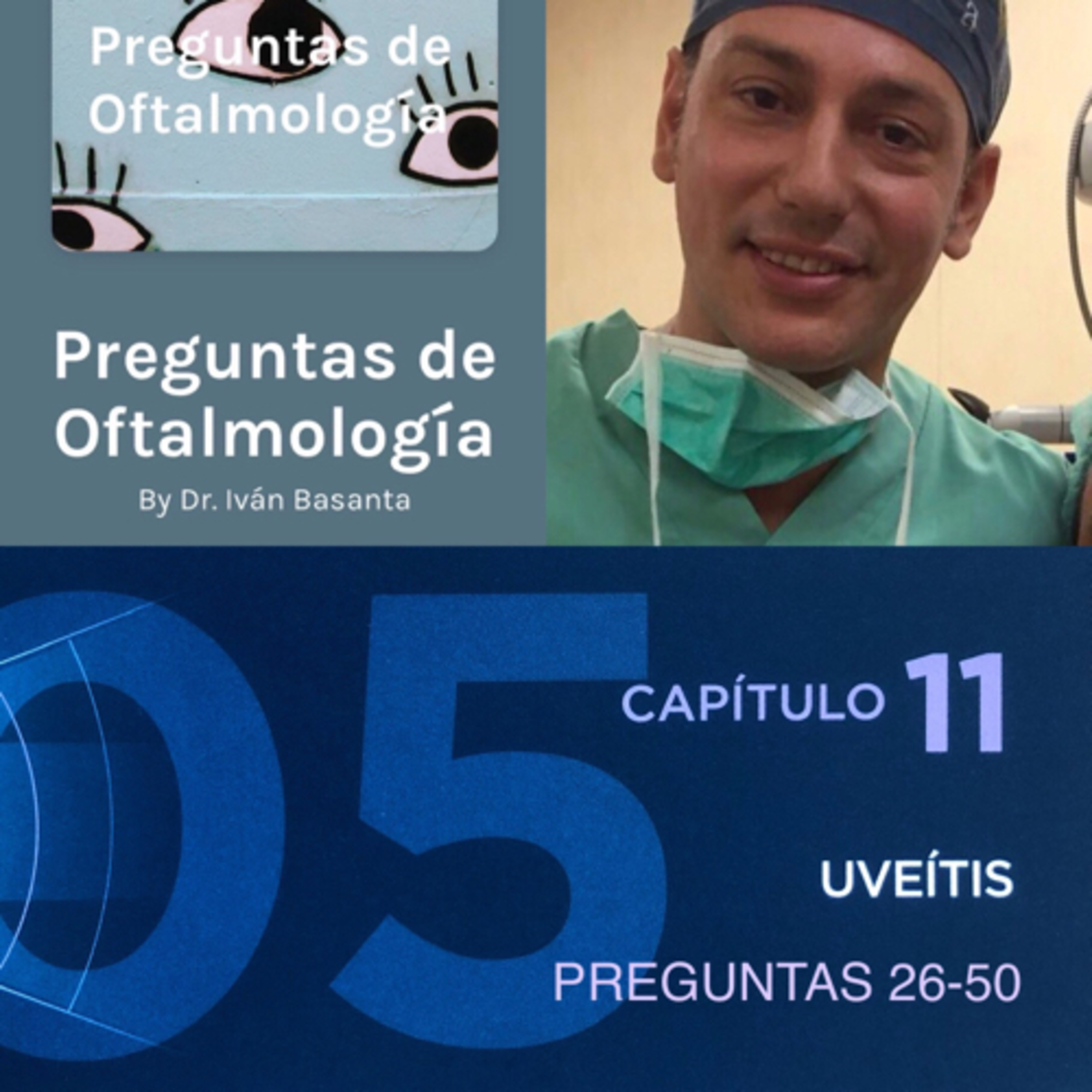 Preguntas de Oftalmología